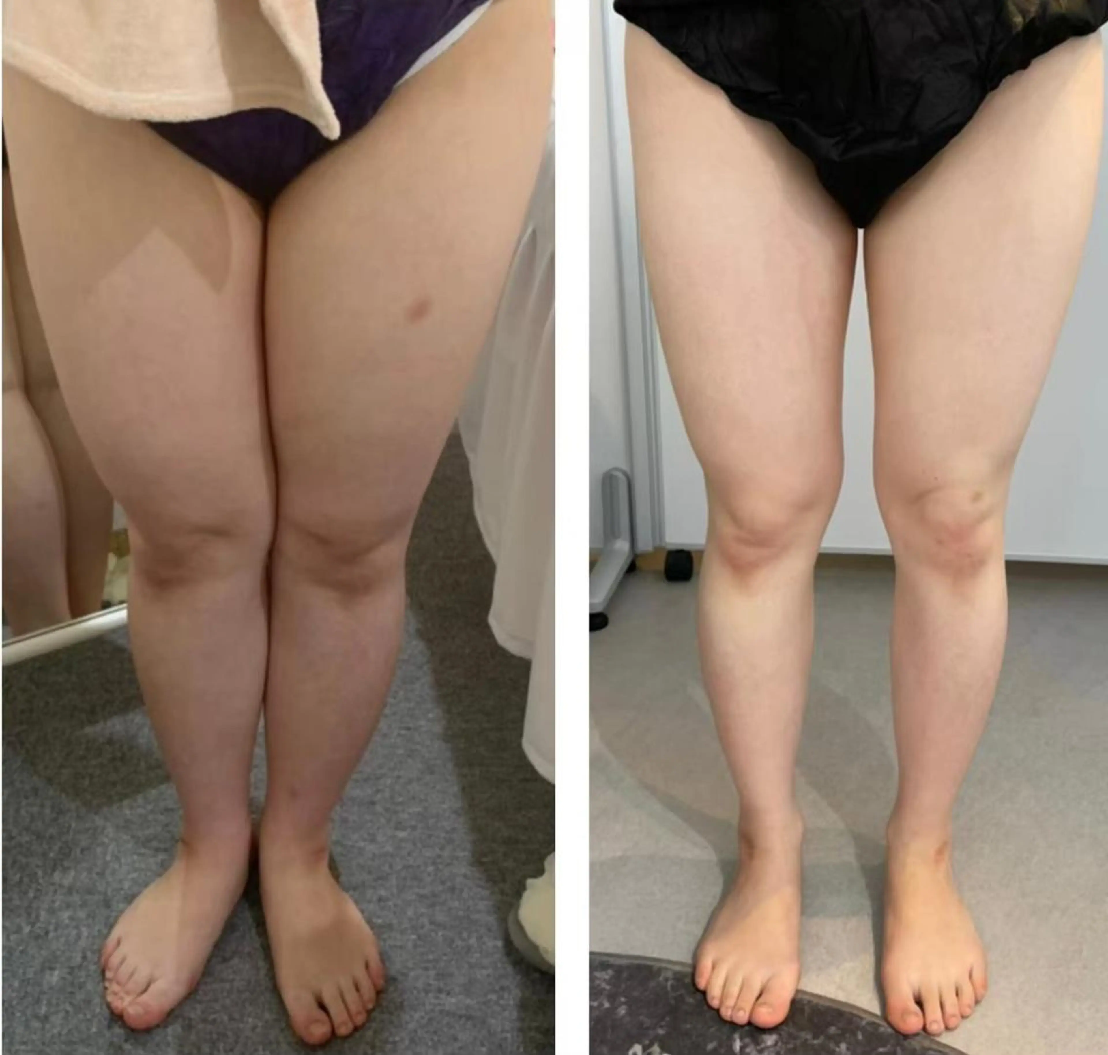 エステ リラク 部分痩せ♥️小顔専門 MIKUのエステ・リラクイメージ