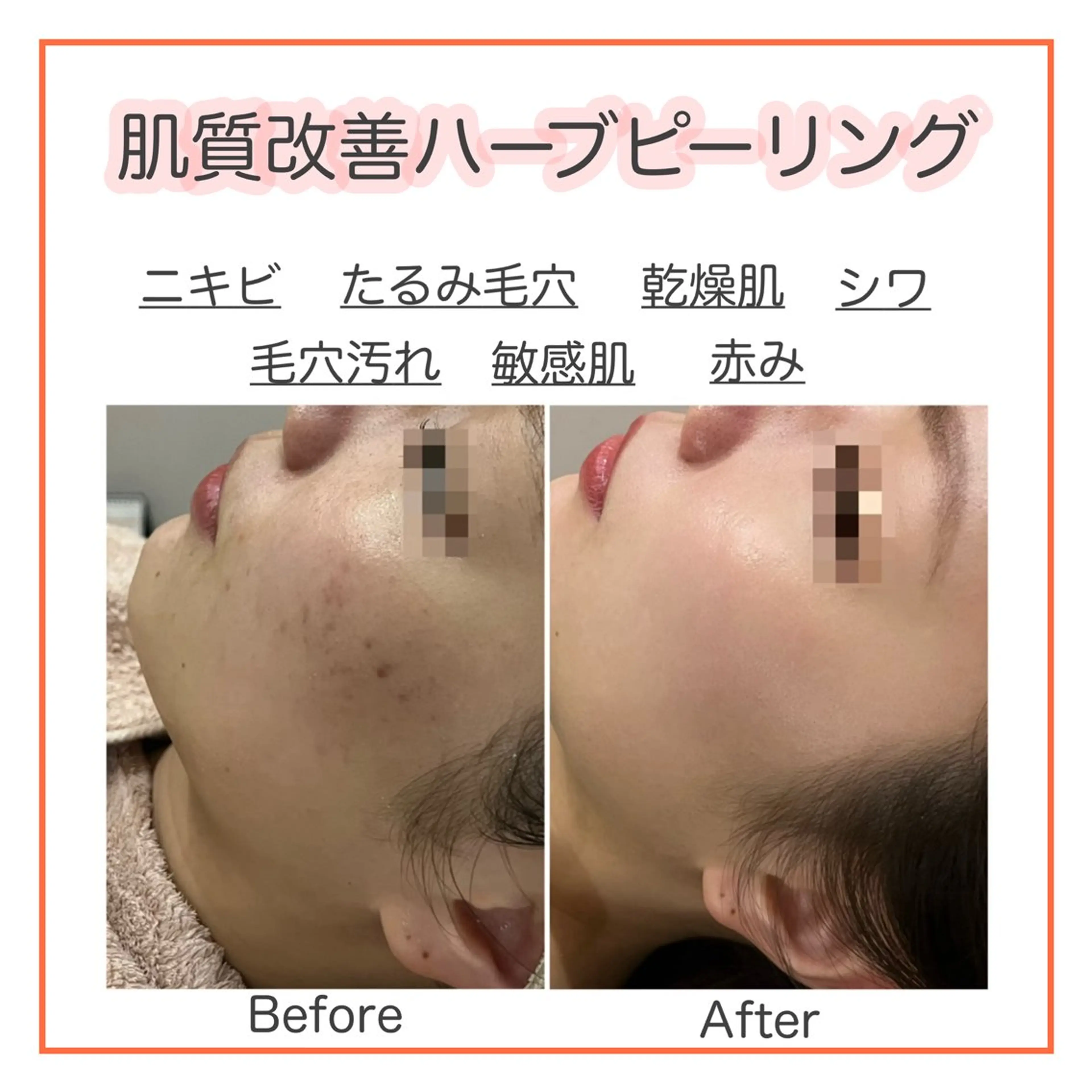 ハーブピーリング専門 muro.のエステ・リラクイメージ