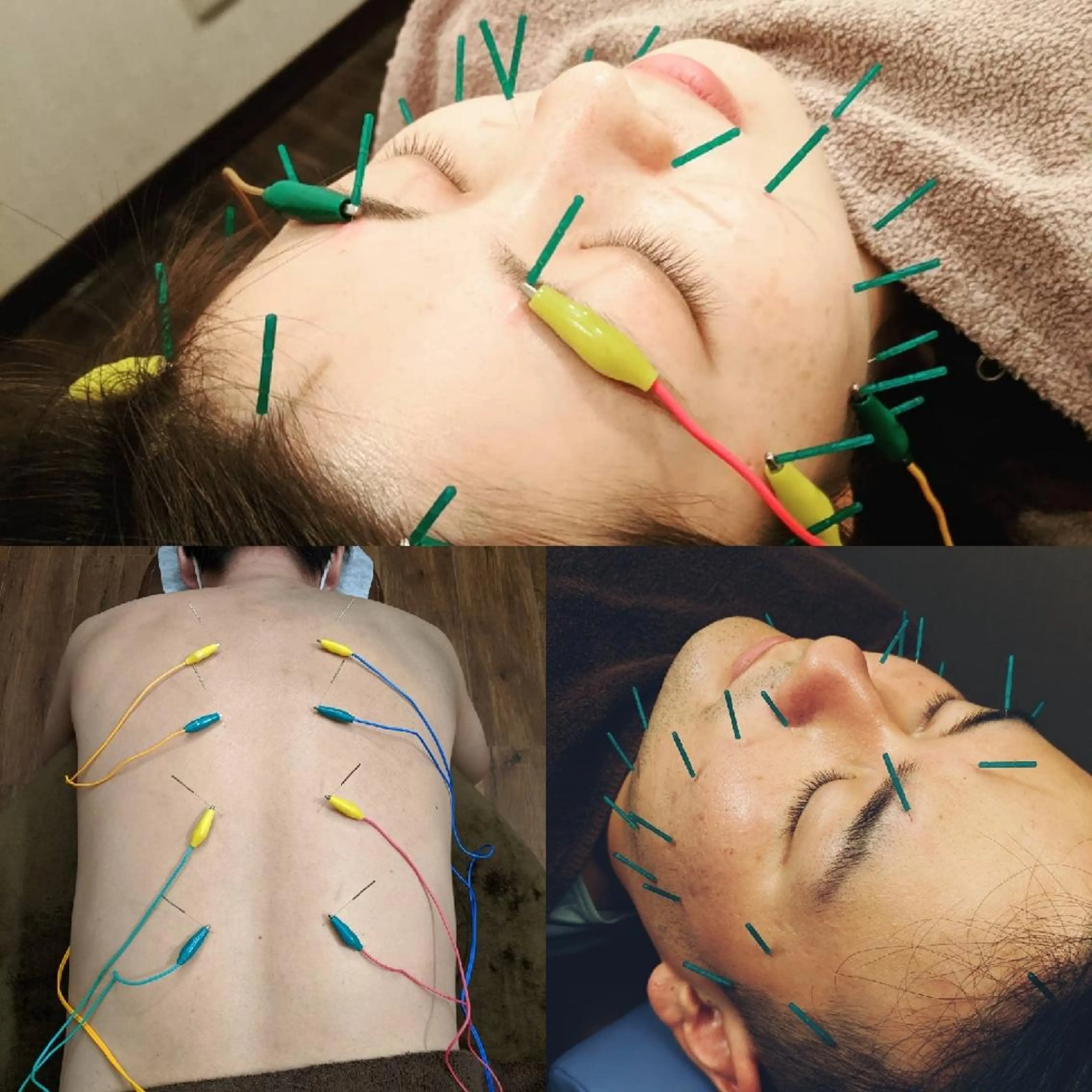 エステ リラク 乃々鍼灸・整体院　表参道所属・乃々鍼灸整体院　植木 　【美容鍼/整体】のエステ・リラクイメージ