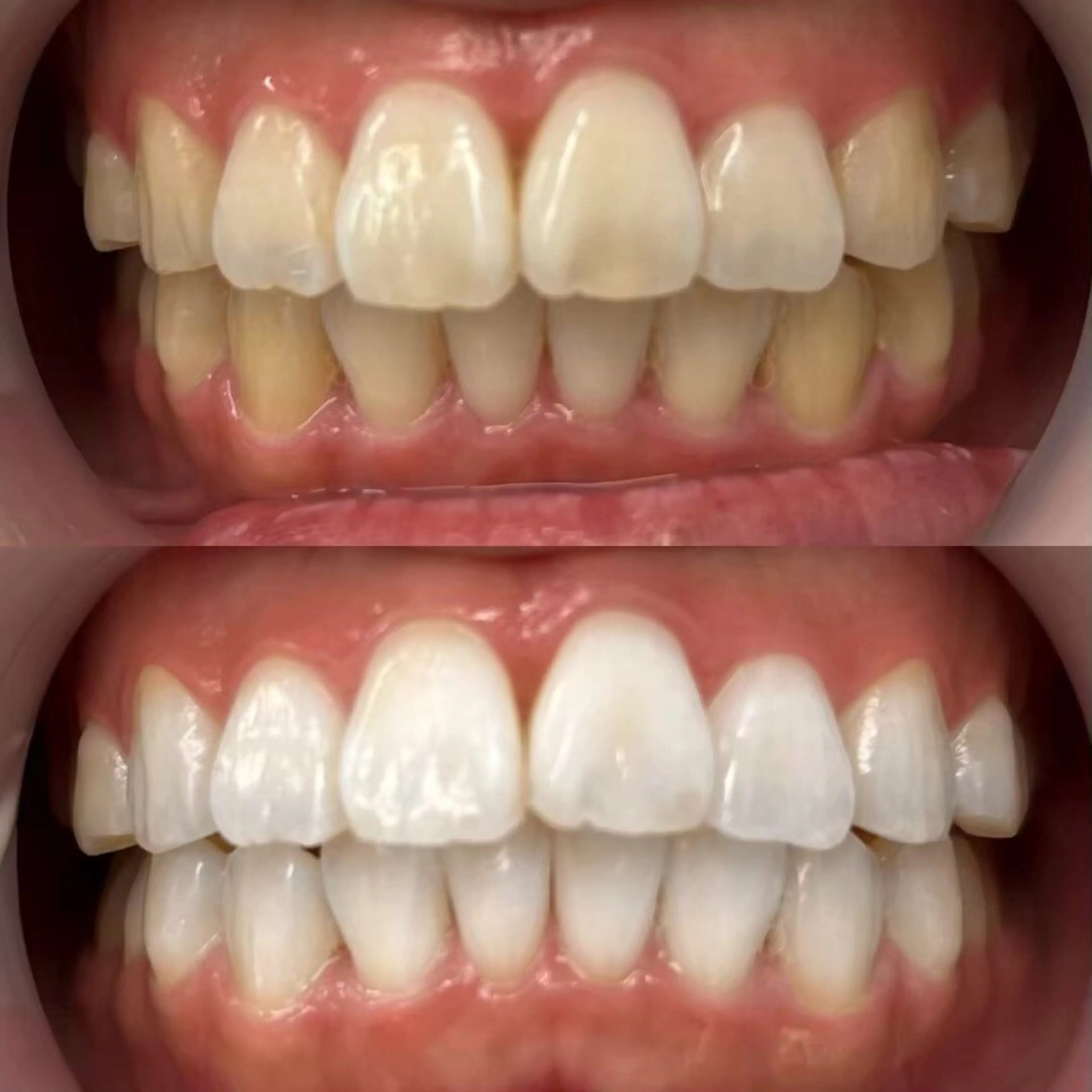 エステ リラク LBSホワイトニング上野店所属・LBSホワイトニング 🌐 上野店公式のエステ・リラクイメージ