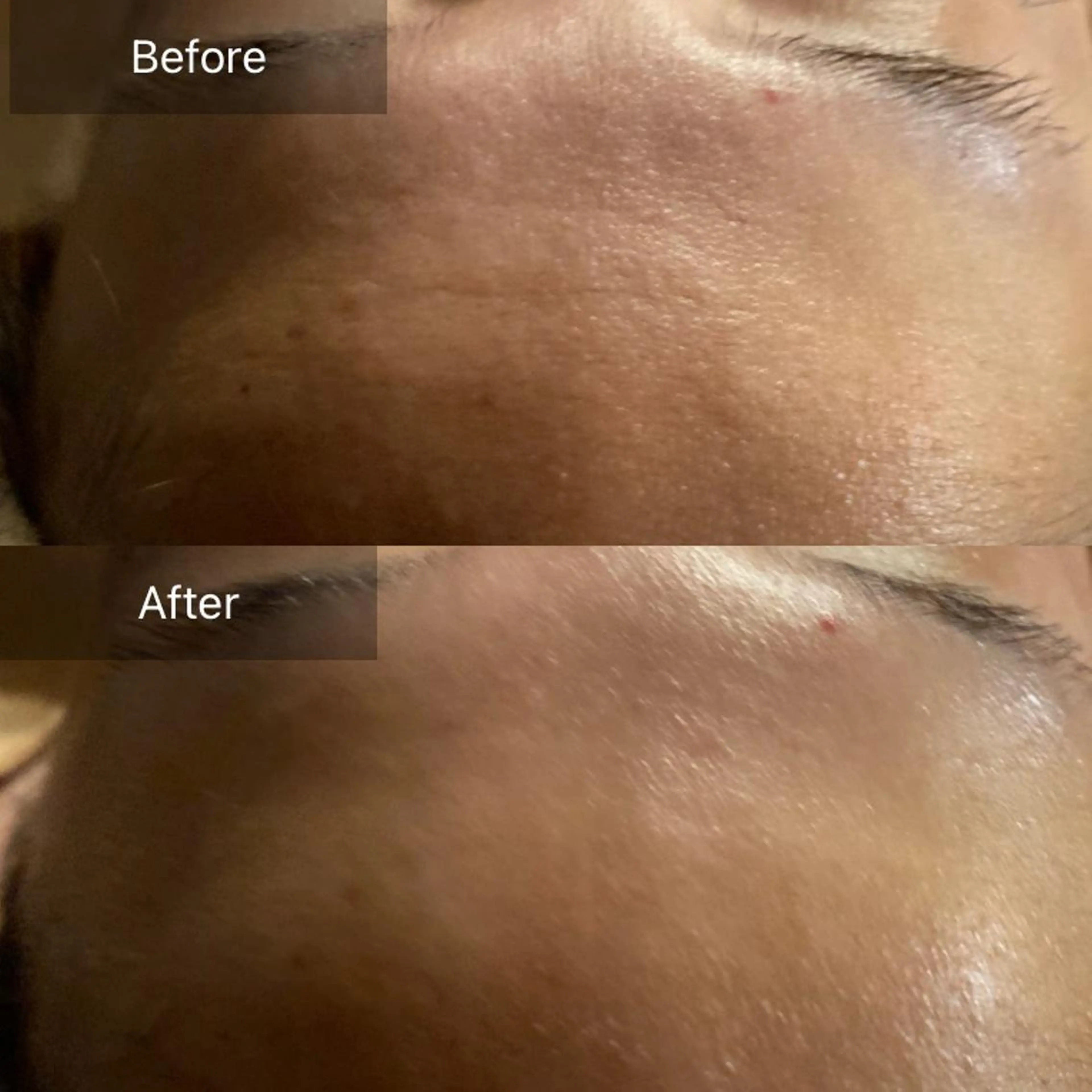 Mandarin Orange所属・毛穴から始める肌メン テマンダリンオレンジのエステ・リラクイメージ