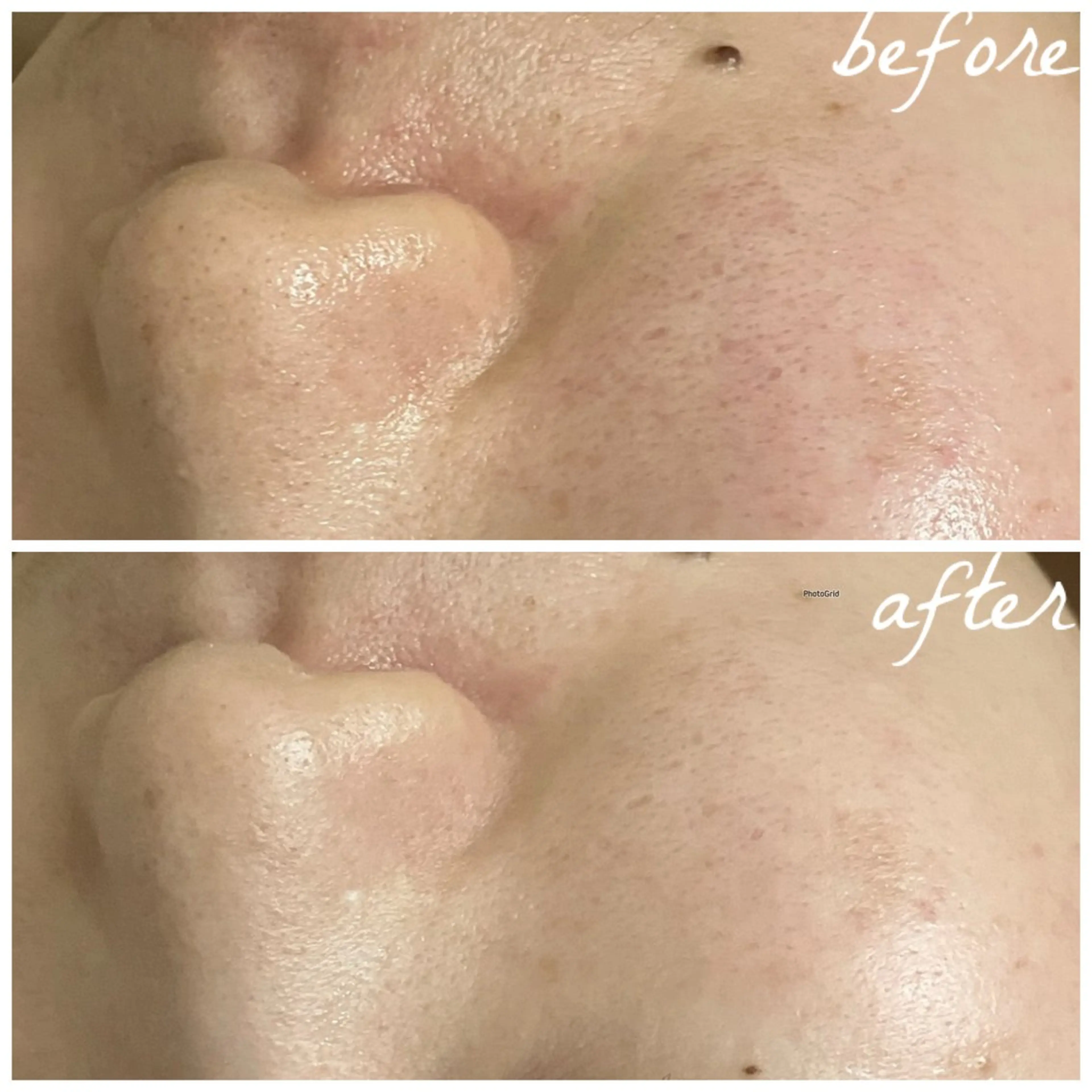 メンズ エステ メナード岐阜茜部 杉浦のエステ・リラクイメージ