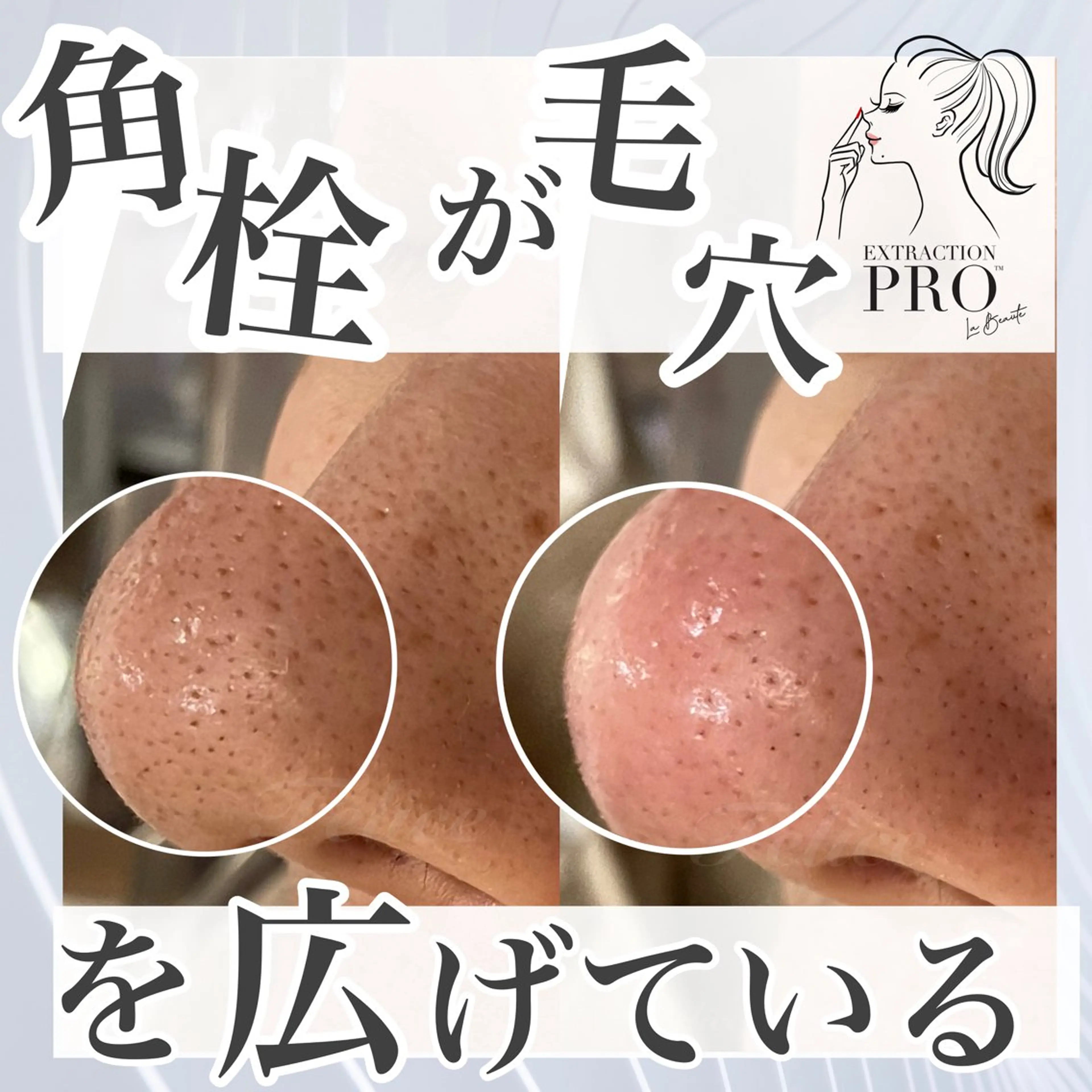 エステ 毛穴ケア✖️まつげ Feliceのマツエク・マツパデザイン