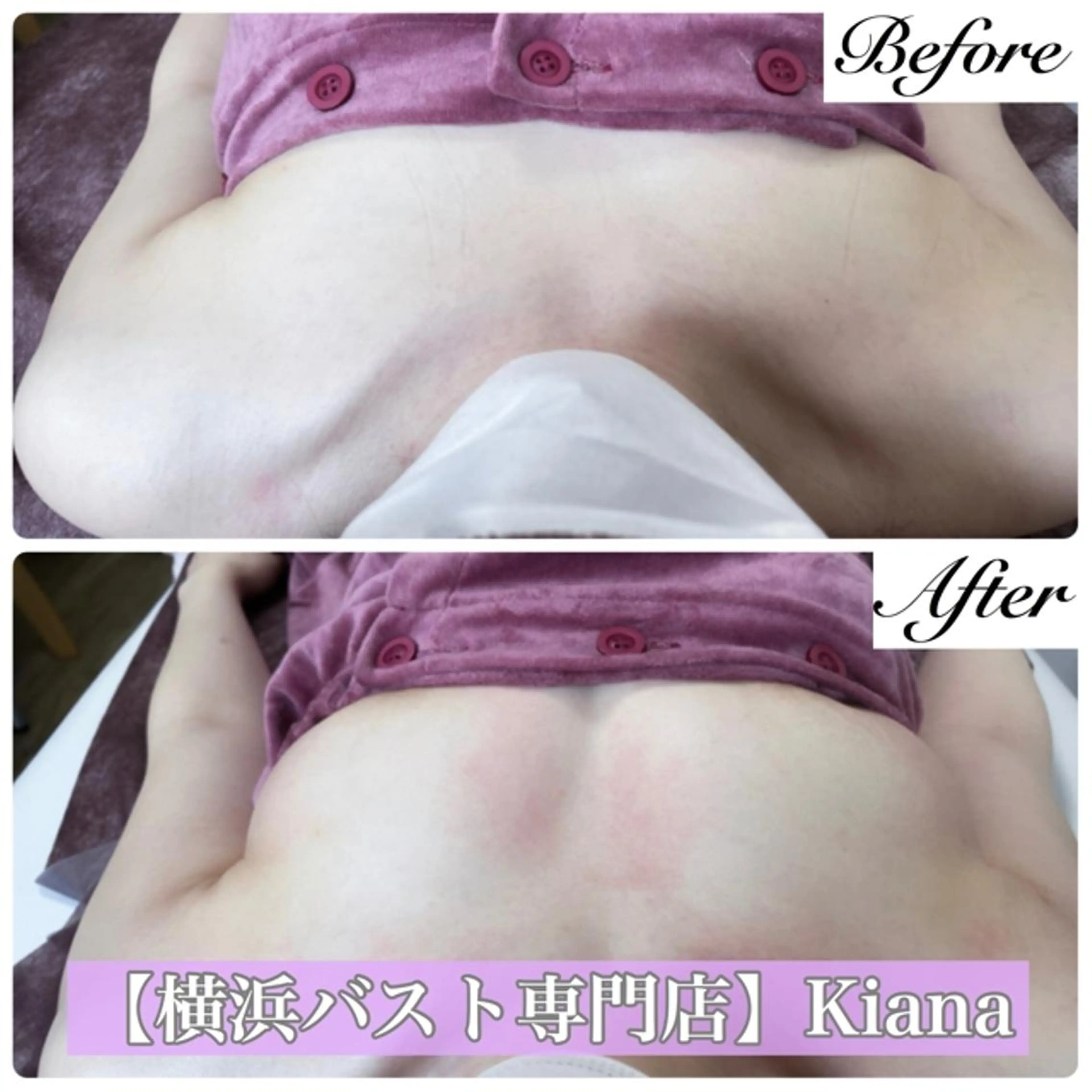 【バスト専門店 】 Kiana のエステ・リラクイメージ