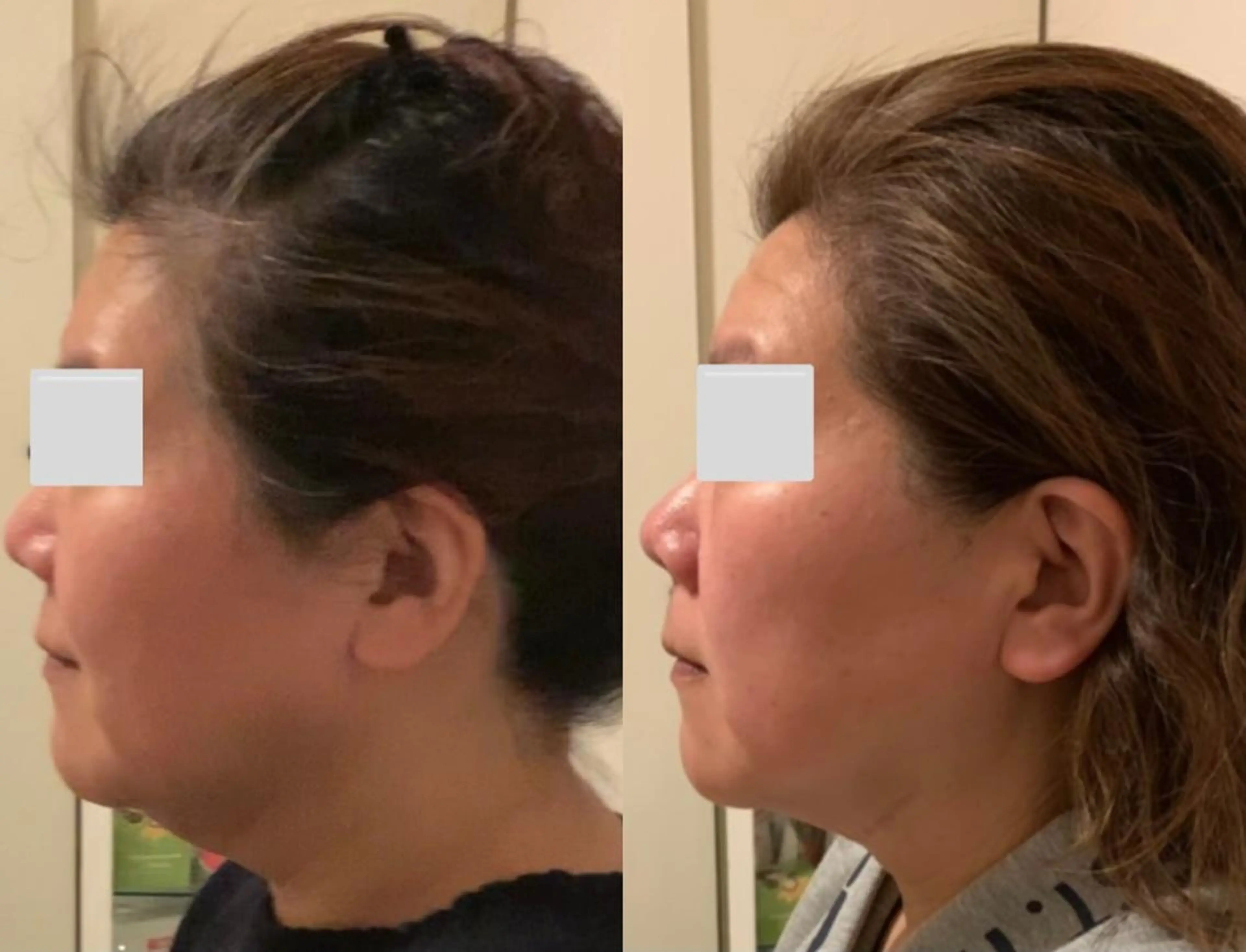 a  room salonのエステ・リラクイメージ