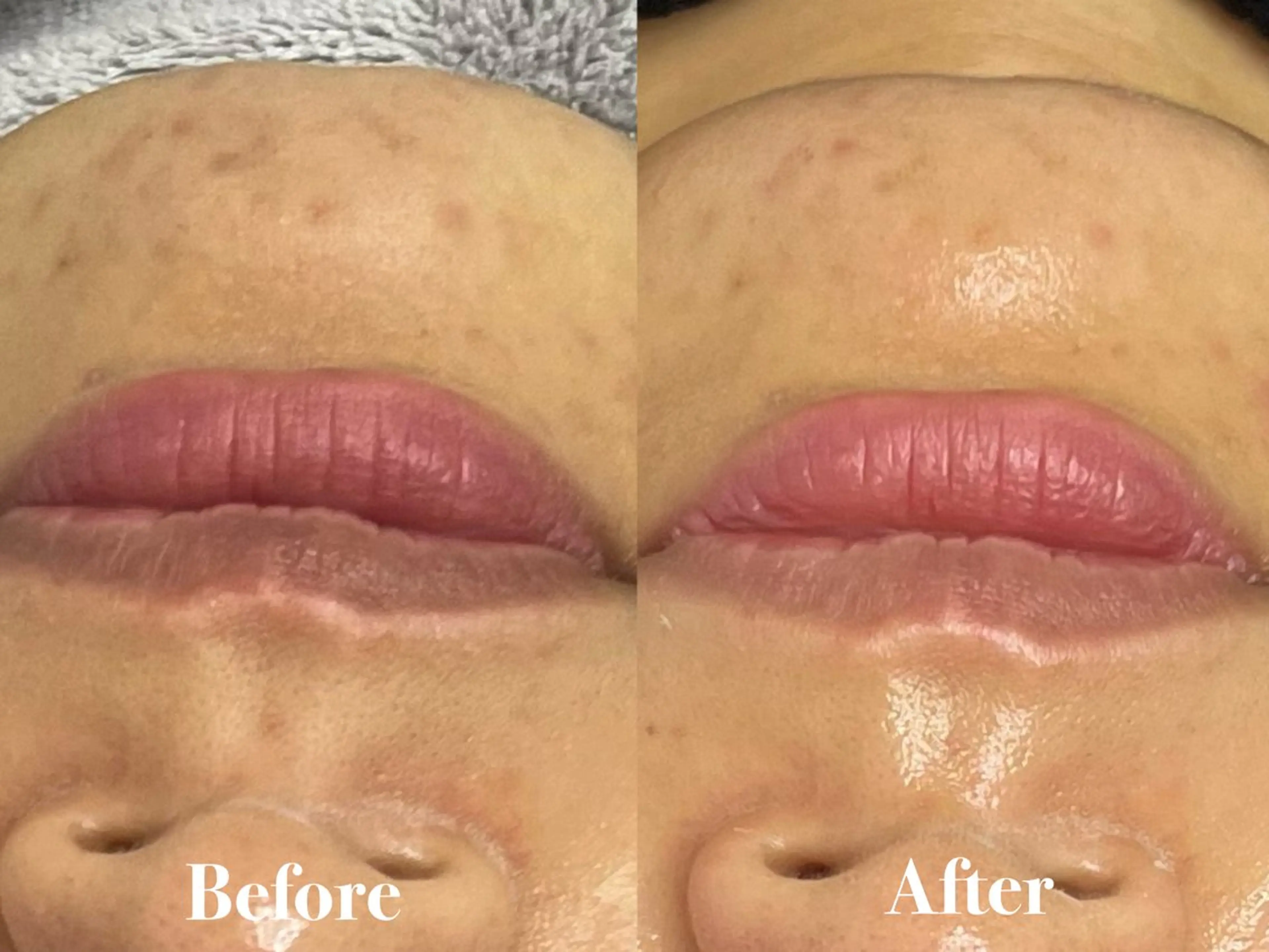 Ailedole 📍東京豊洲のその他イメージ