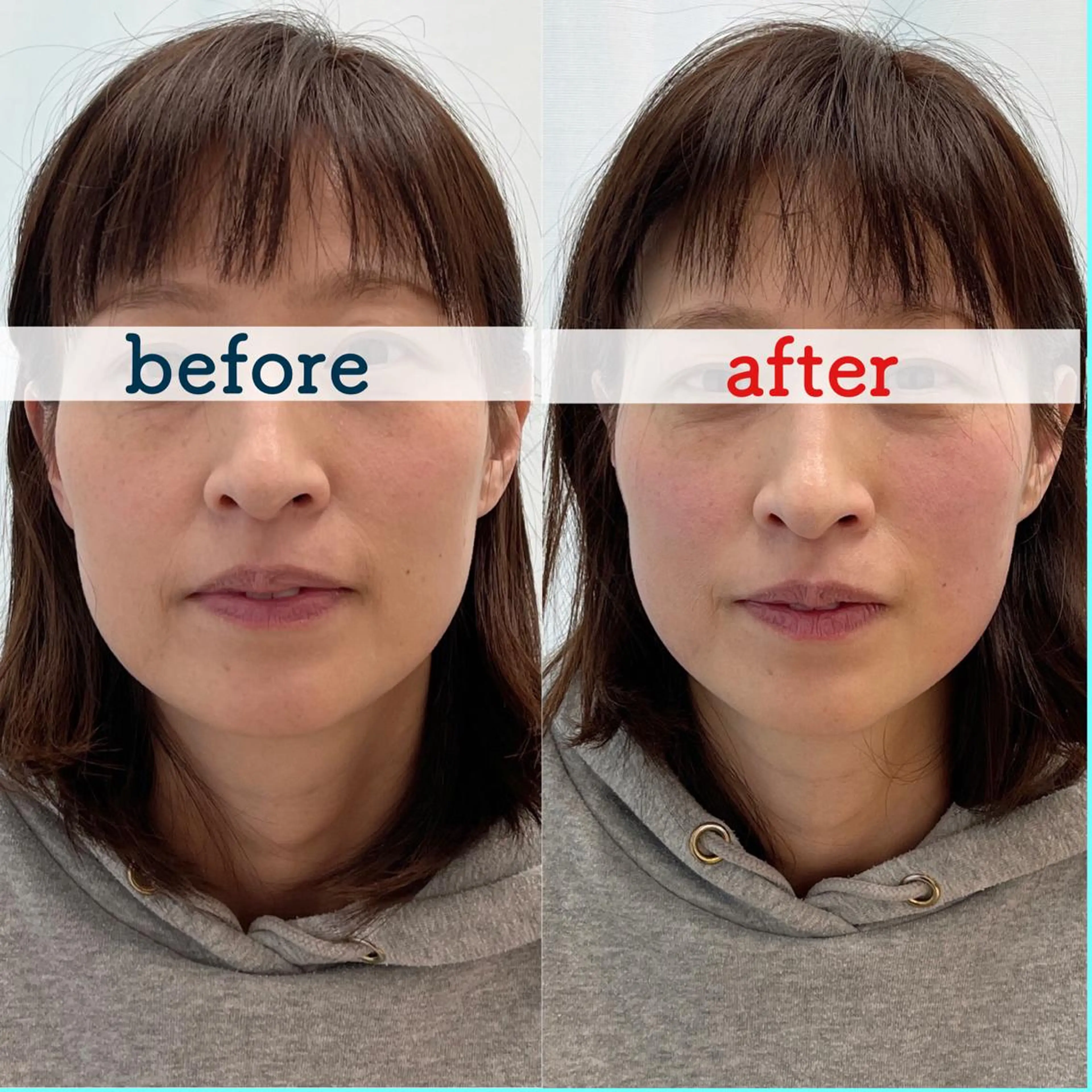 小林整骨院　下総中山所属・津田 龍平のその他イメージ