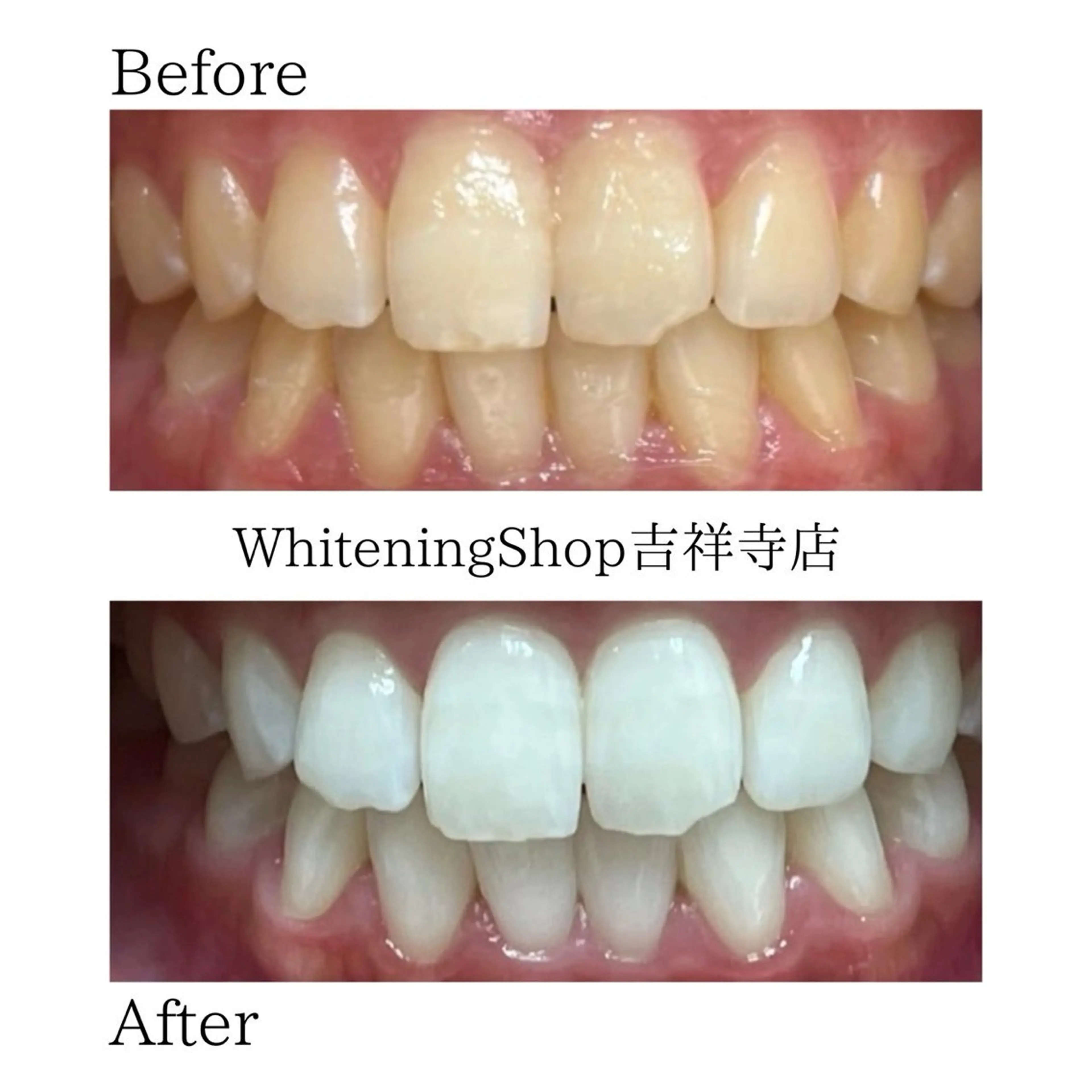 ホワイトニングショッ 吉祥寺2号店のエステ・リラクイメージ