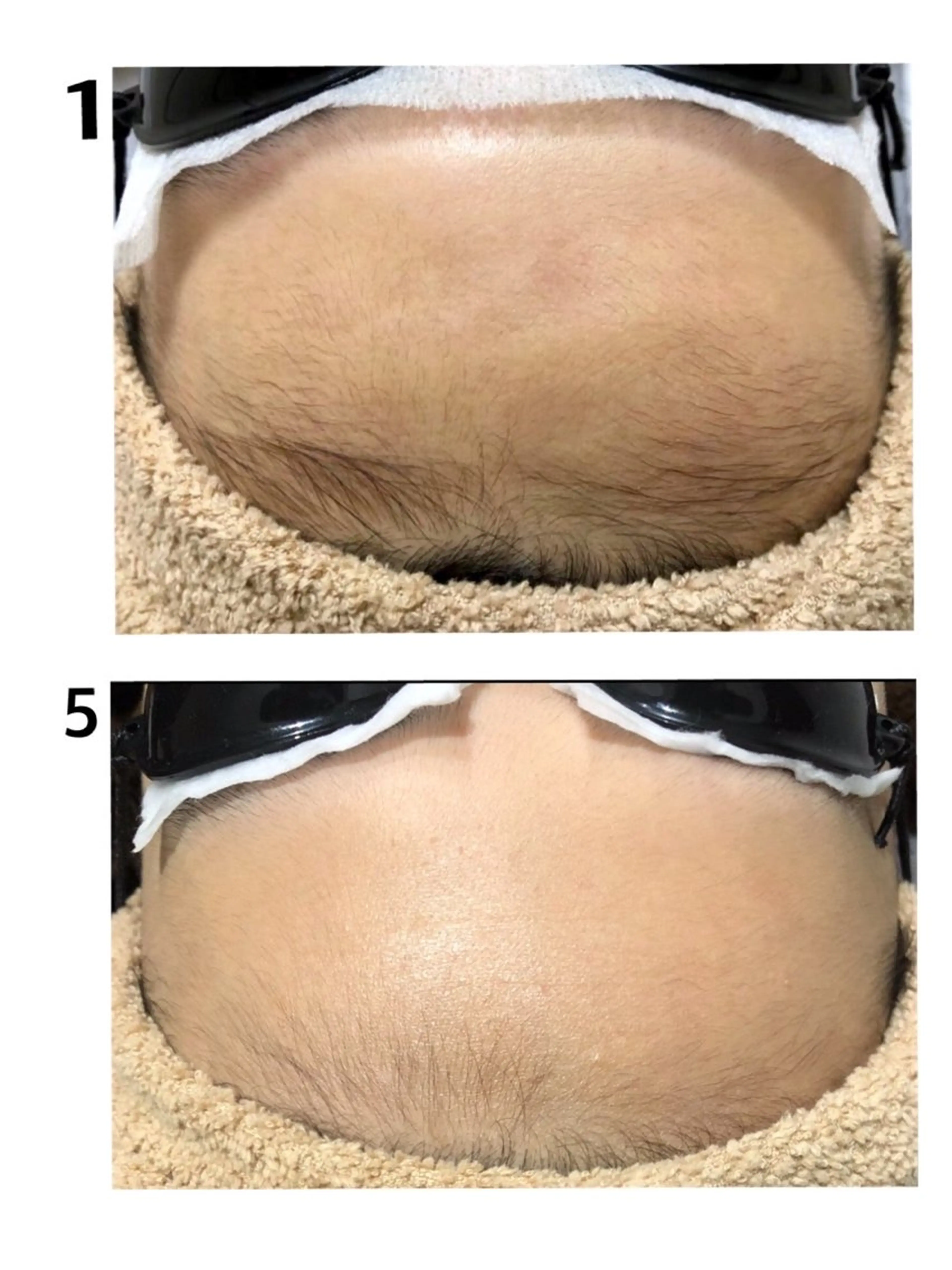 Laule'a ラウレアのエステ・リラクイメージ