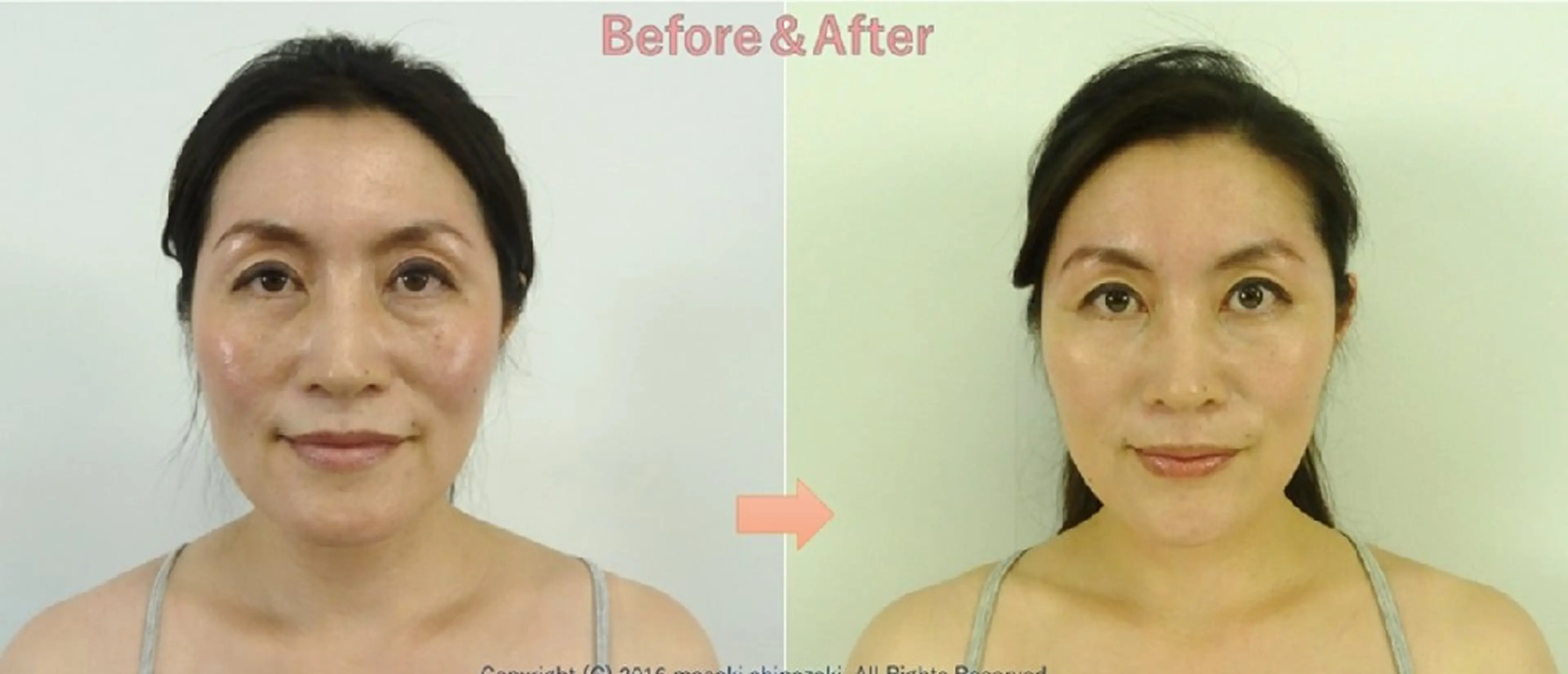 エステ リラク 美容整体サロン DOLCE のエステ・リラクイメージ