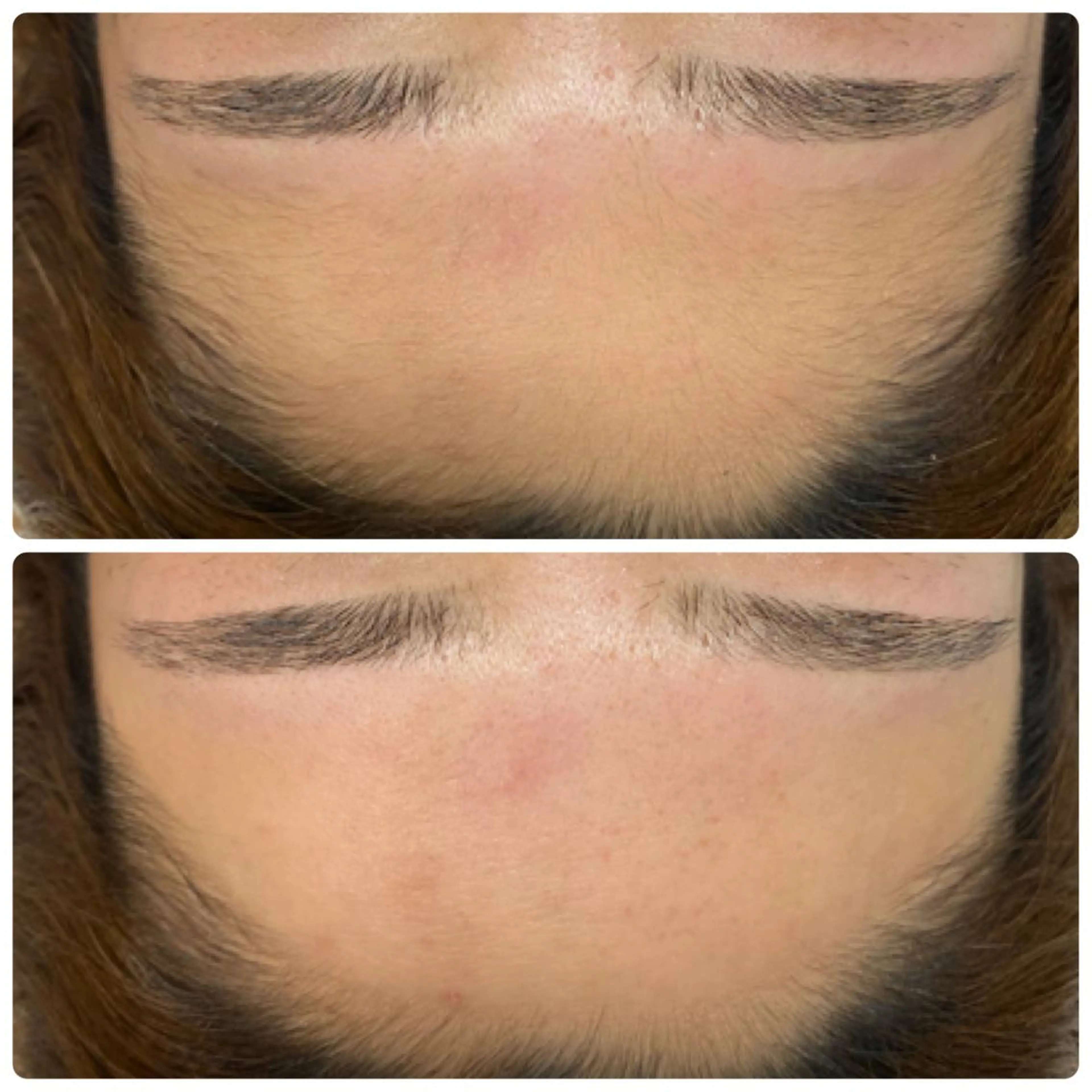 アイブロウ ワックス脱毛 眉カット その他(アイブロウ) Olu所属・ai /Oluの眉毛・アイブロウイメージ