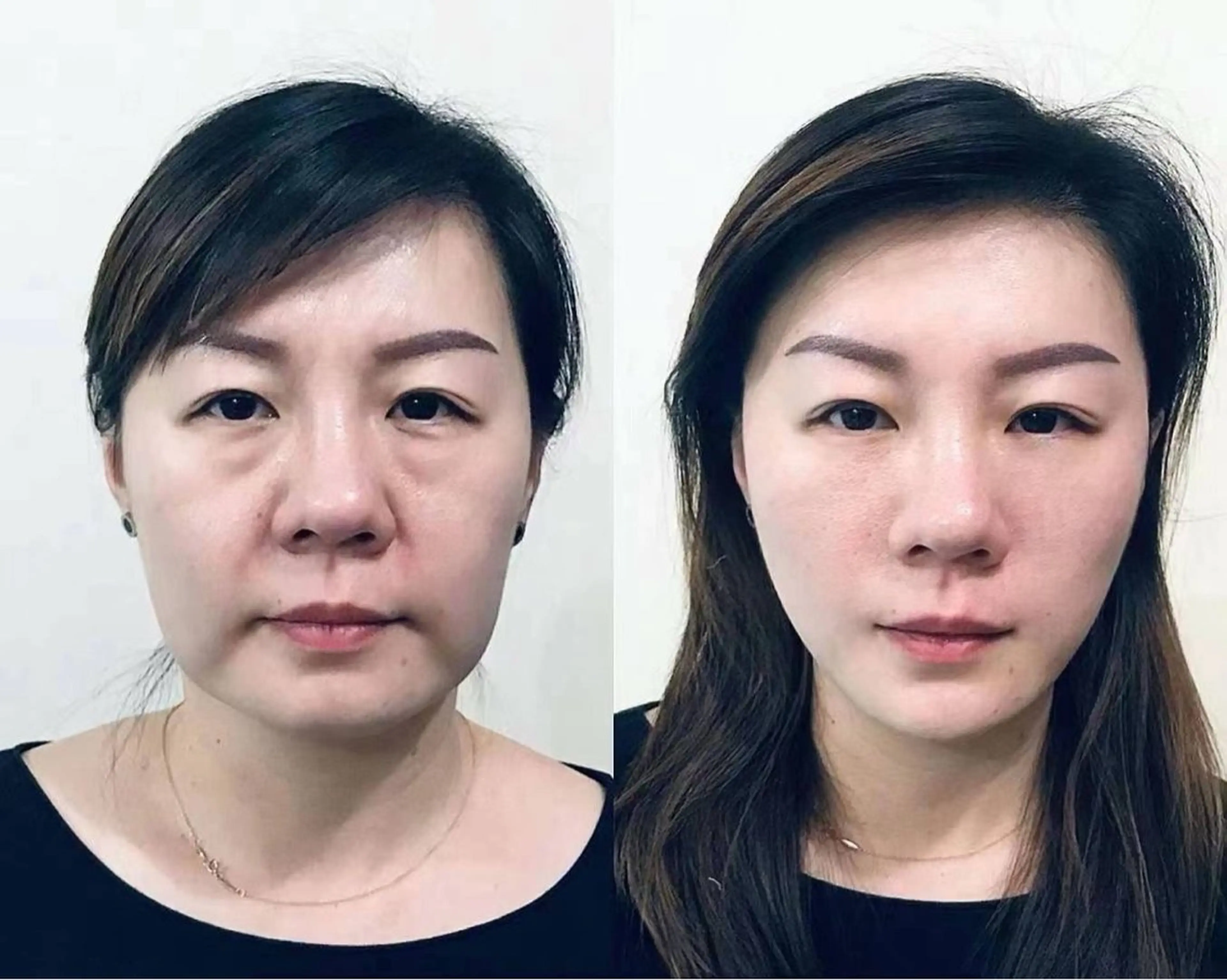 マツエク・マツパ エステ aliaハイフ&水光ジェットサロン所属・aliaハーブ水光店 エステティシャン募集のエステ・リラクイメージ