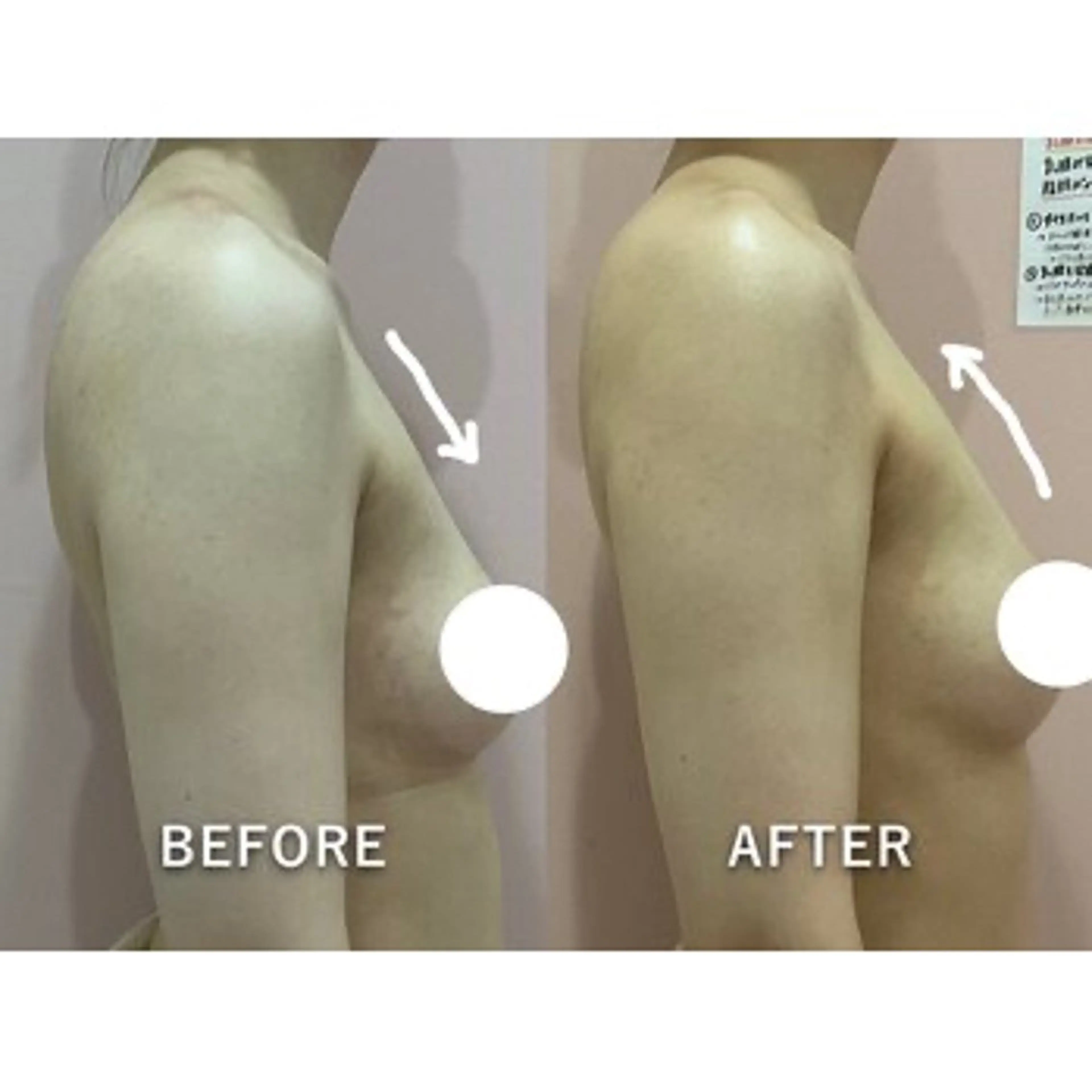 【痩身/ダイエット】 オーバイワン横浜🍓のエステ・リラクイメージ