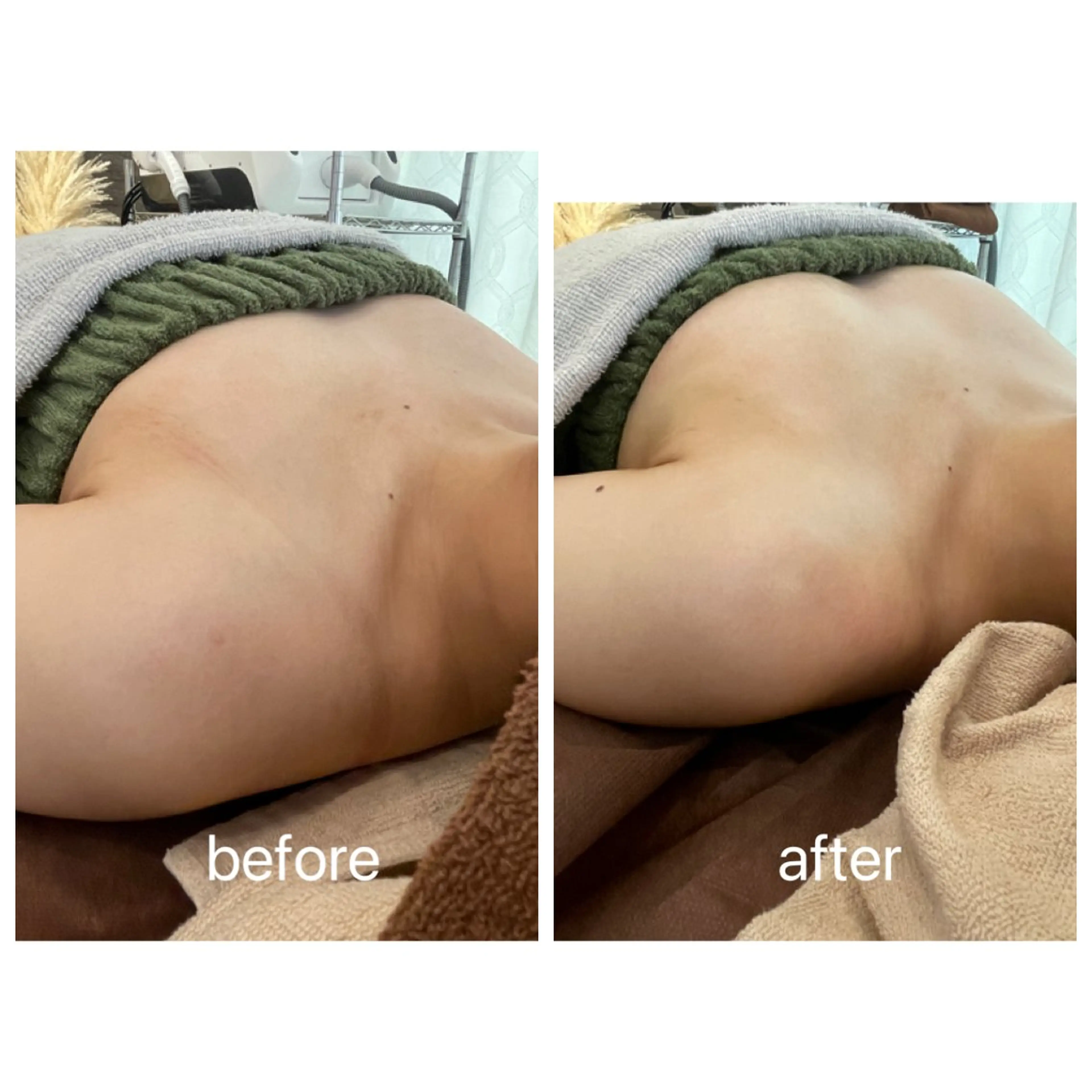 Rene 慢性疲労ケアサロンのエステ・リラクイメージ