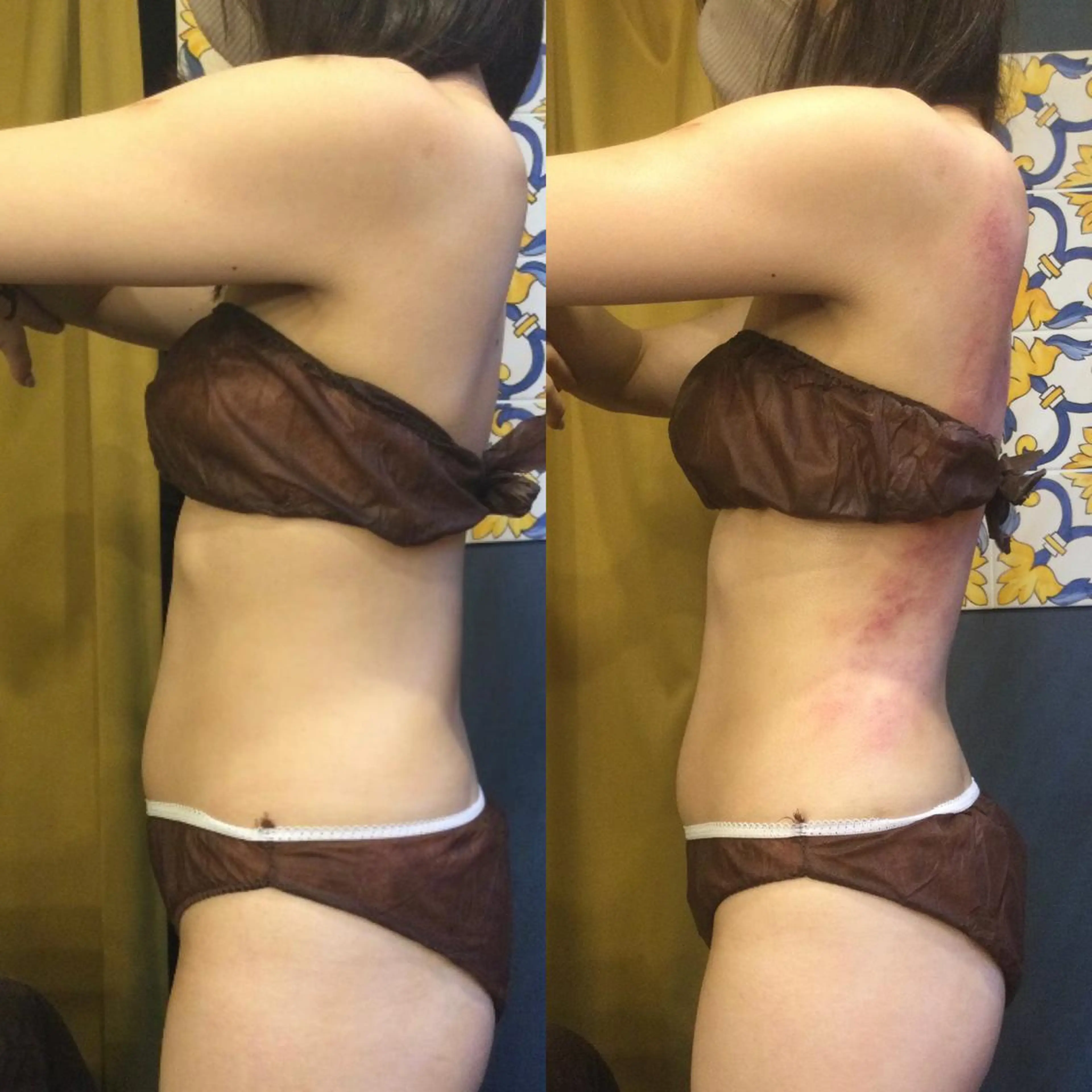 その他 小顔やたるみに特化 💚野瀬可蓮のその他イメージ