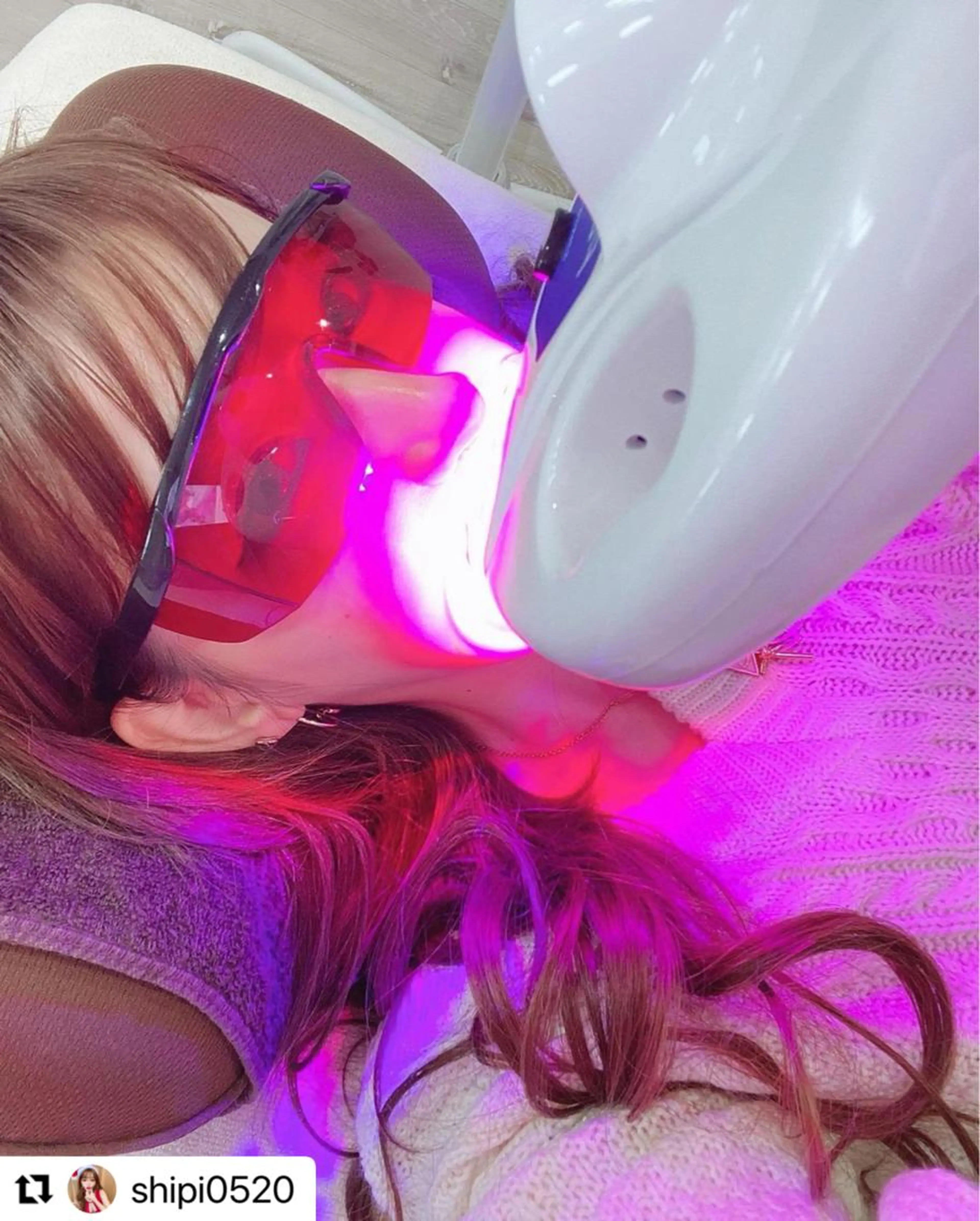 【初回限定】強力集中ケアで理想の白さに✨痛くない超強力ハイパワーホワイトニング‼️合計40分照射💫の写真