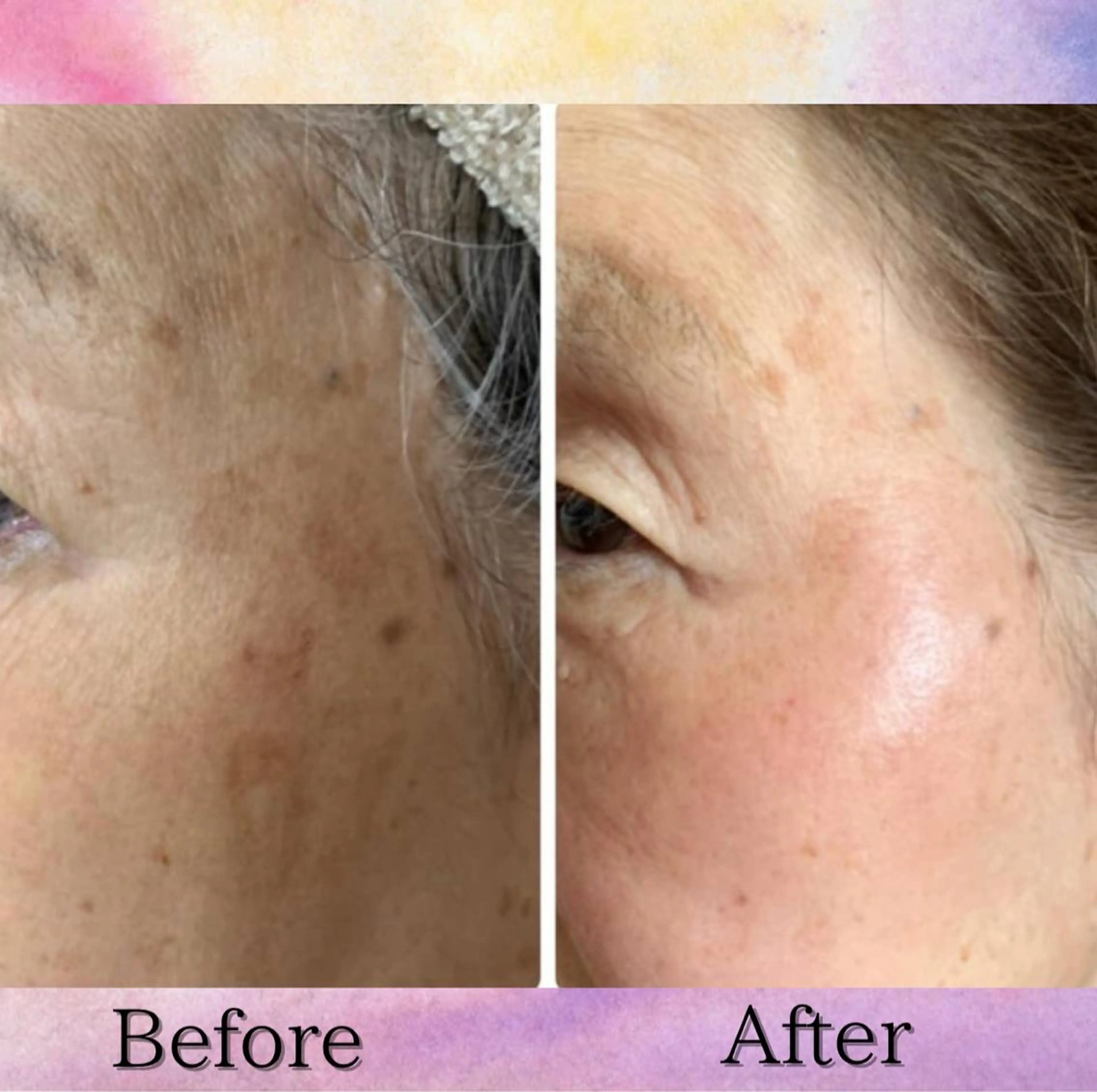 Lumiere despoir所属・Lumiere despoirのエステ・リラクイメージ