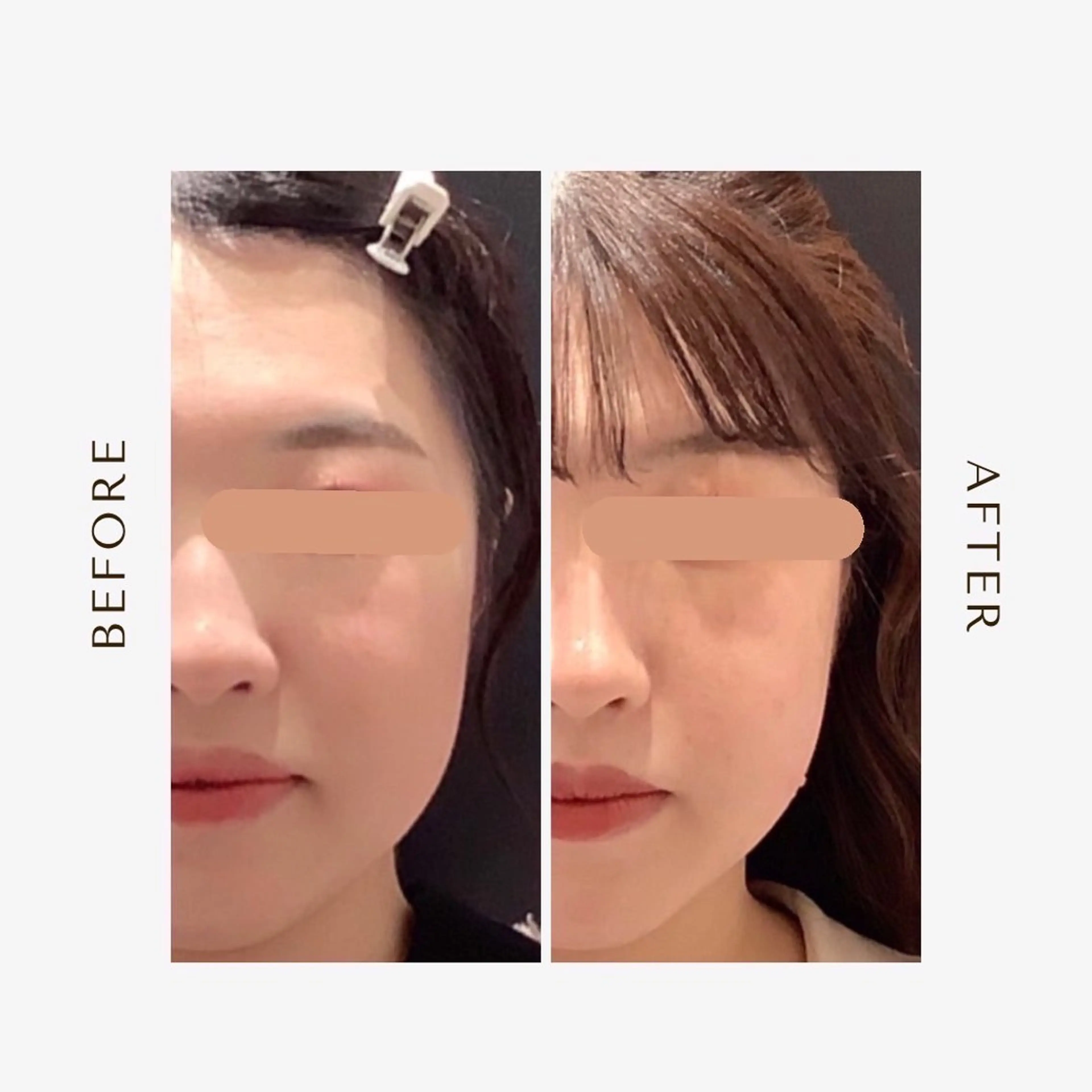 エステ 最速小顔・肌質管理 espoirマキのエステ・リラクイメージ