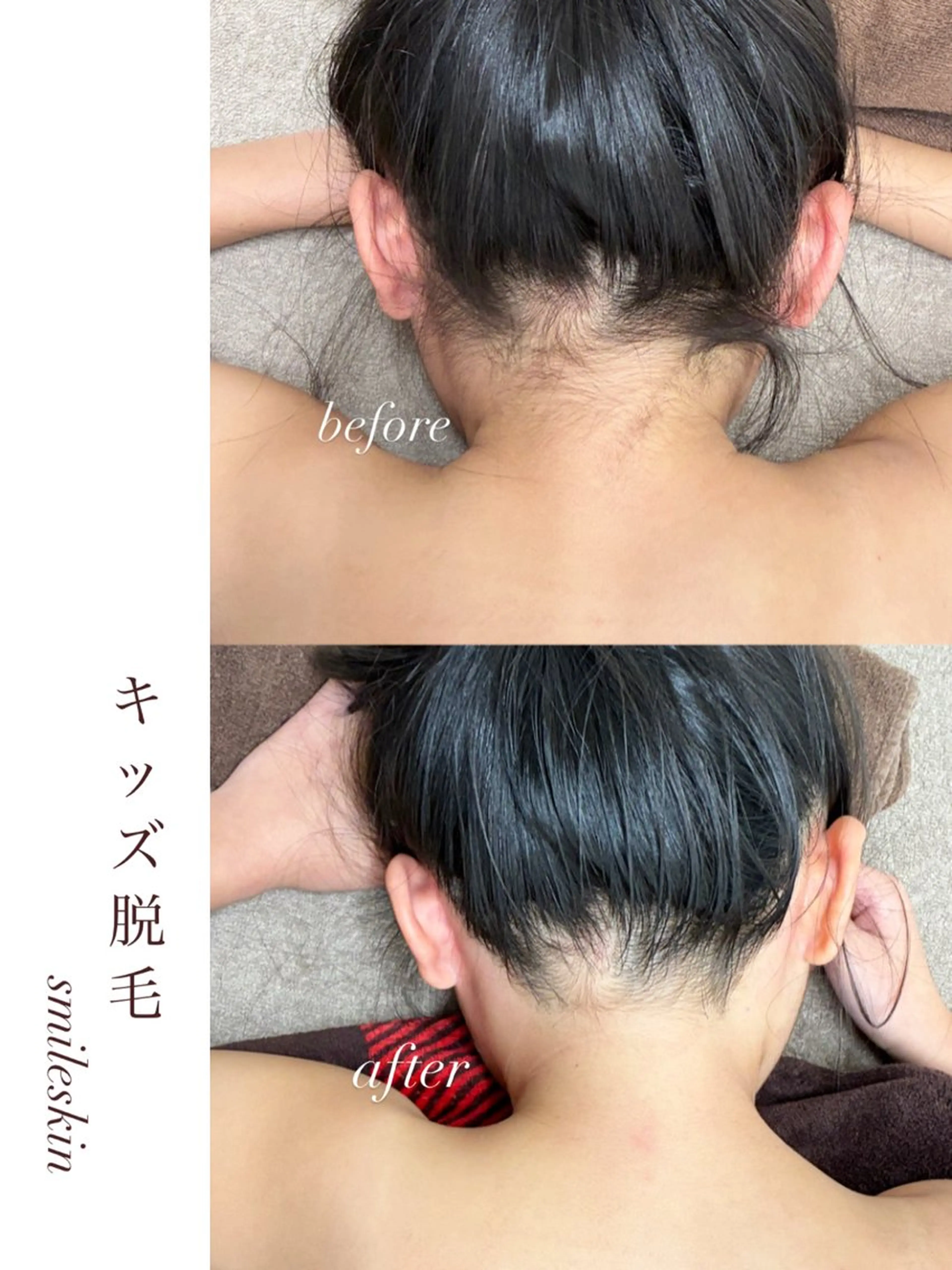 キッズ smileskin 京都／meguのその他イメージ