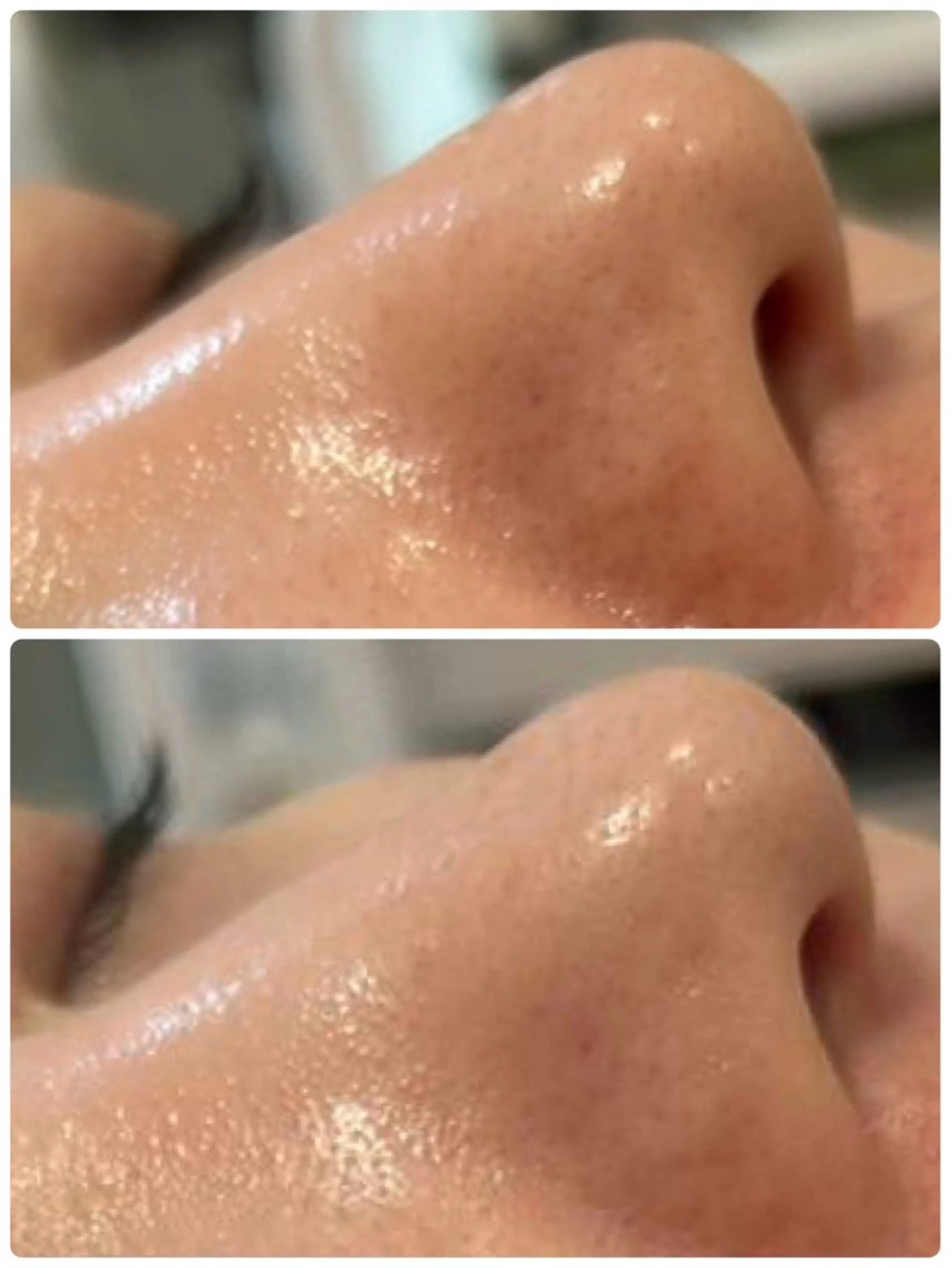 エステ エステサロン イーズ所属・安城市美肌 イーズのエステ・リラクイメージ