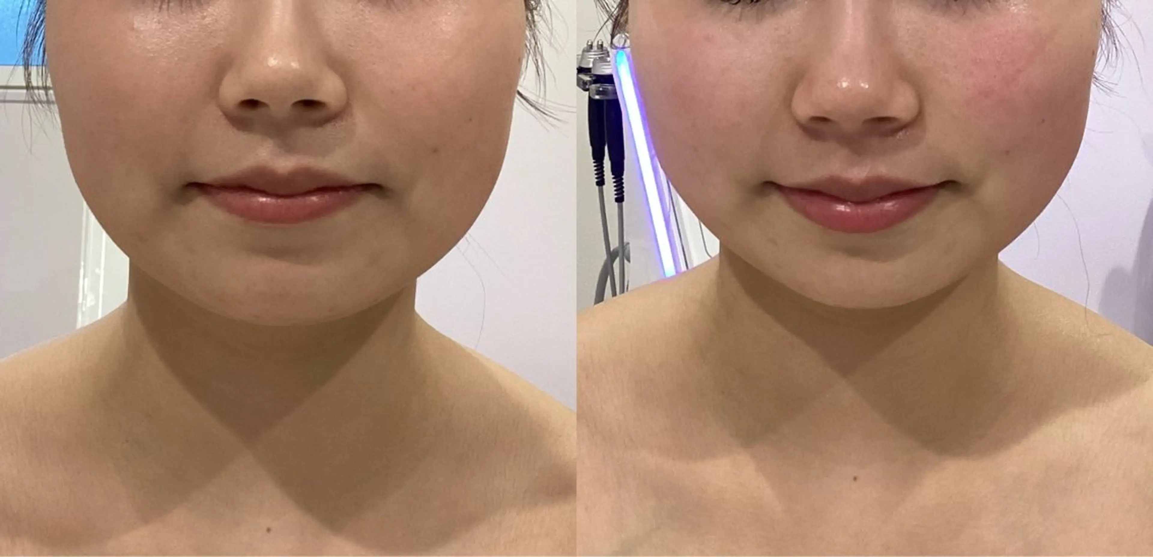 エステ segar 菅野枝里子のエステ・リラクイメージ