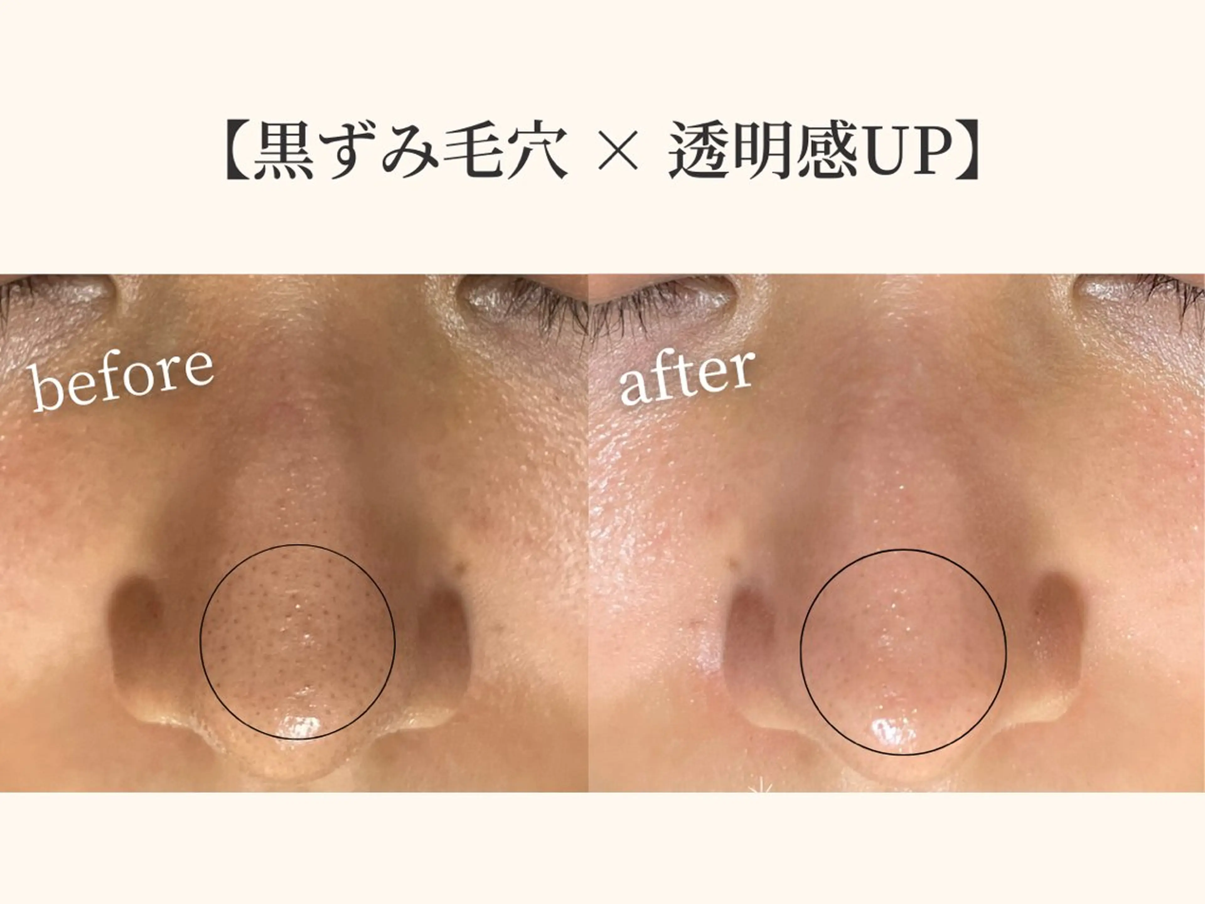 毛穴ケア専門サロン＆ドライヘッドスパ【毛穴洗浄 | ララピール】DREAM SPA町田店所属・小顔矯正×毛穴サロン DRRAMSPA町田のエステ・リラクイメージ