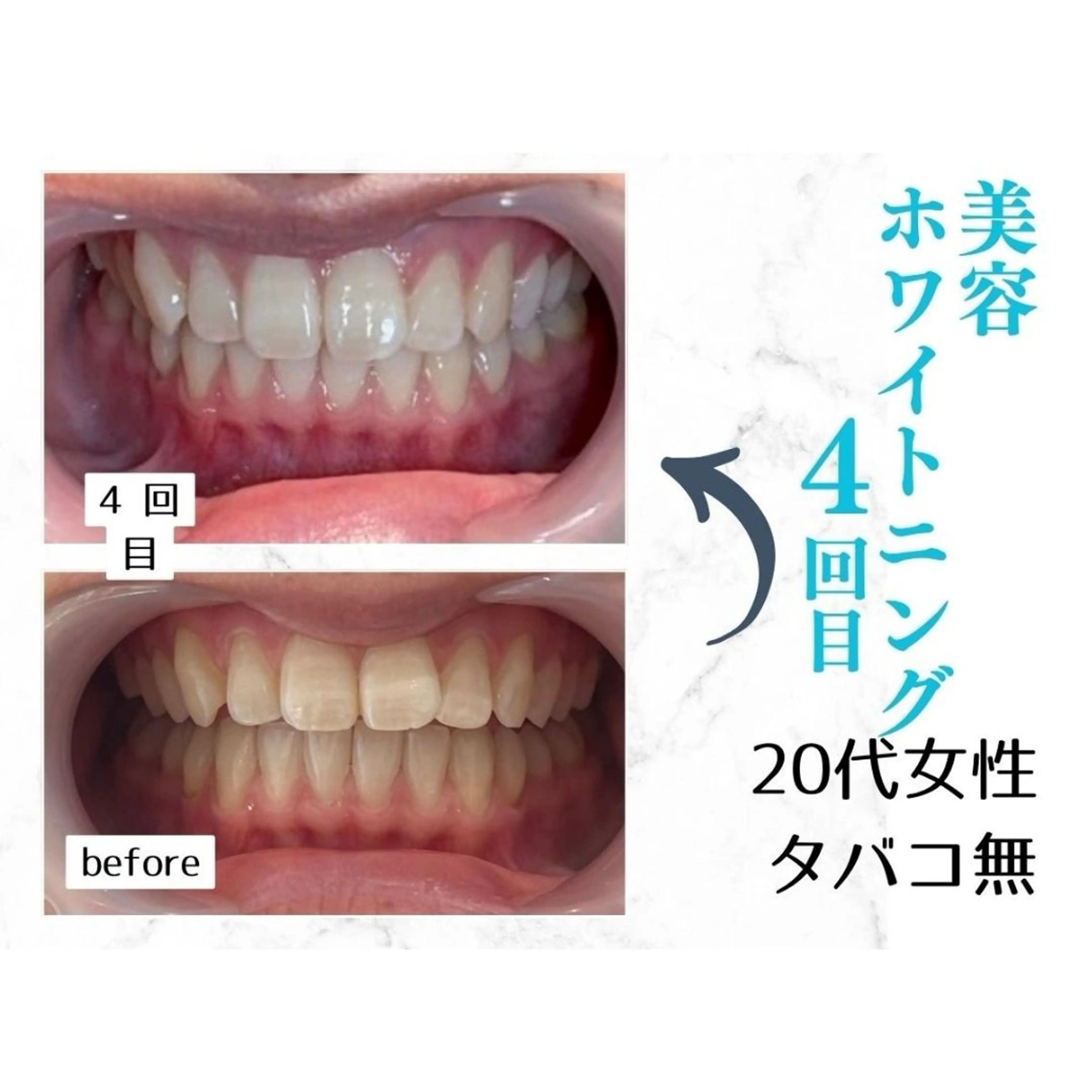 ホワイトニングサロン le  canonのその他イメージ