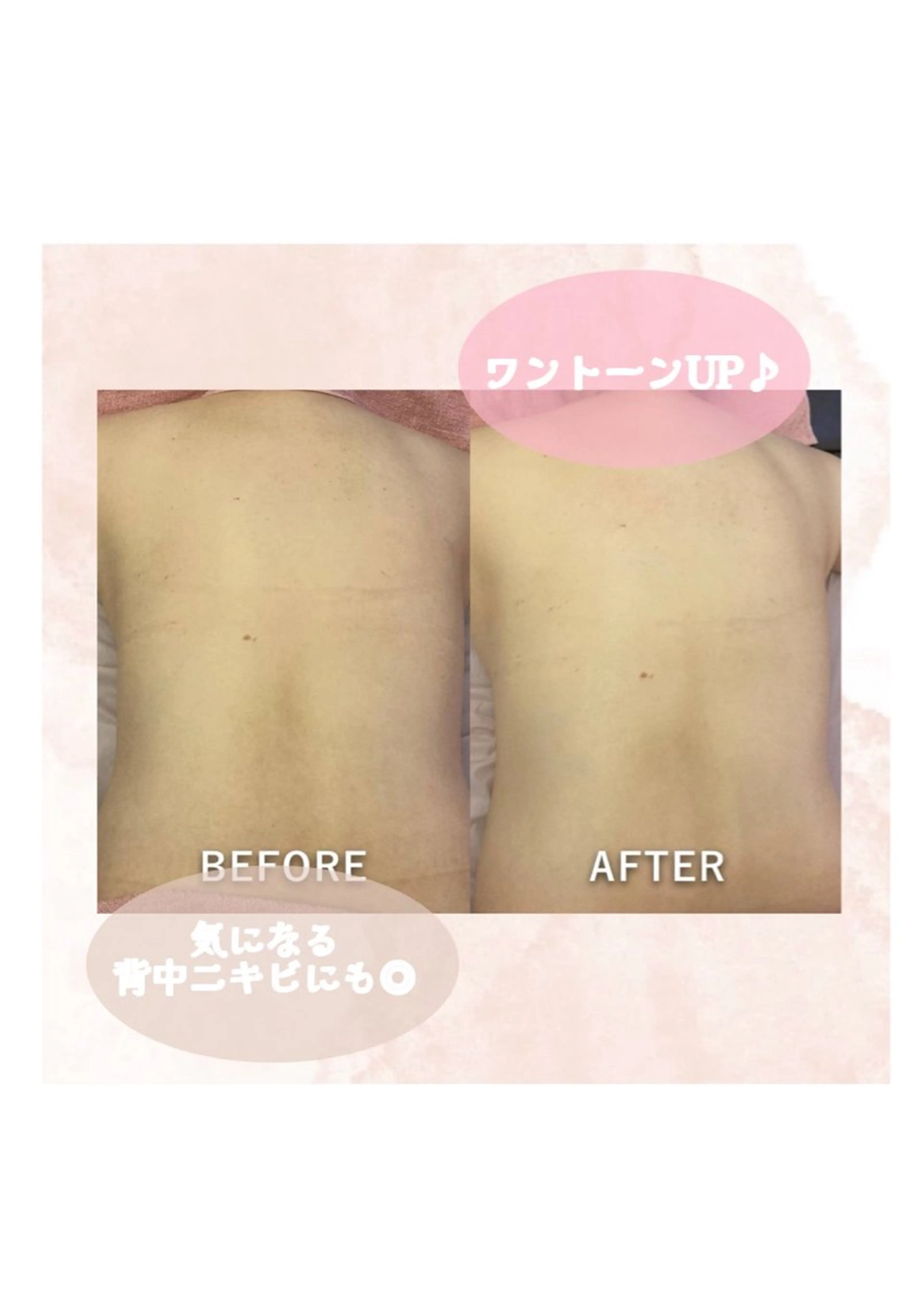 hitohana所属・毛穴/いちご鼻/小顔 /hitohanaのエステ・リラクイメージ