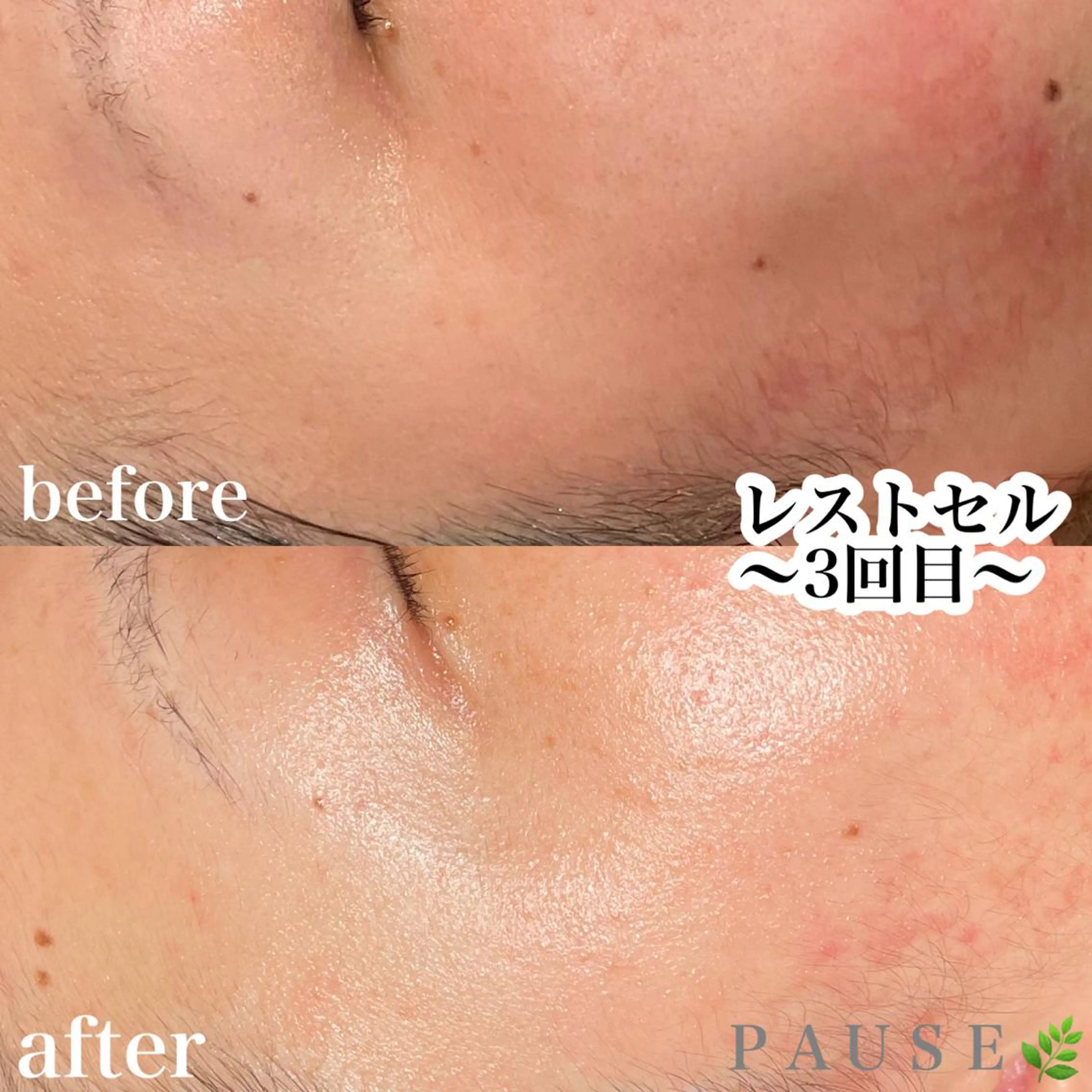 エステ リラク 浜野 恵美のエステ・リラクイメージ