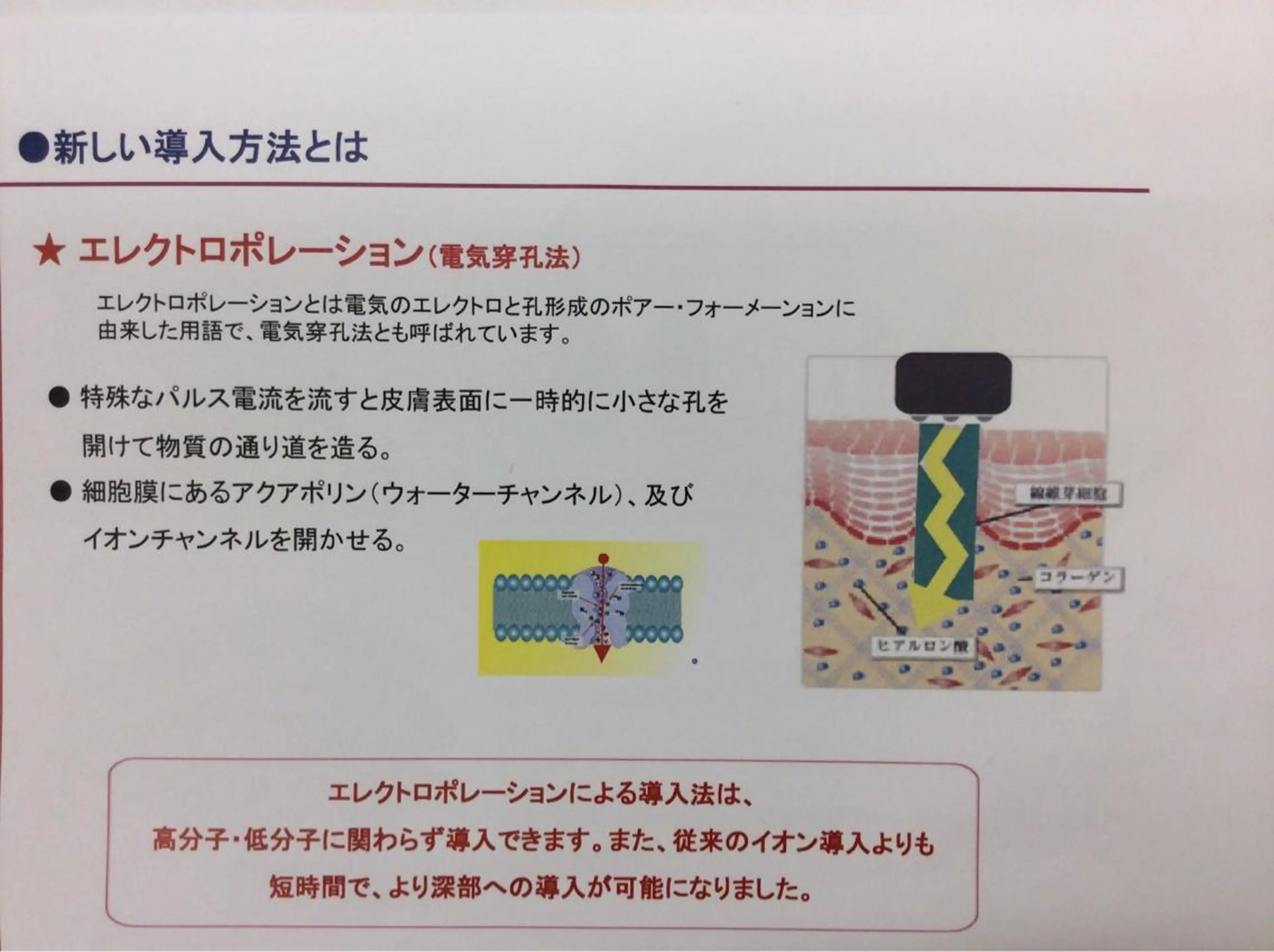 ジョリ   ヴェール 山口のマツエク・マツパデザイン