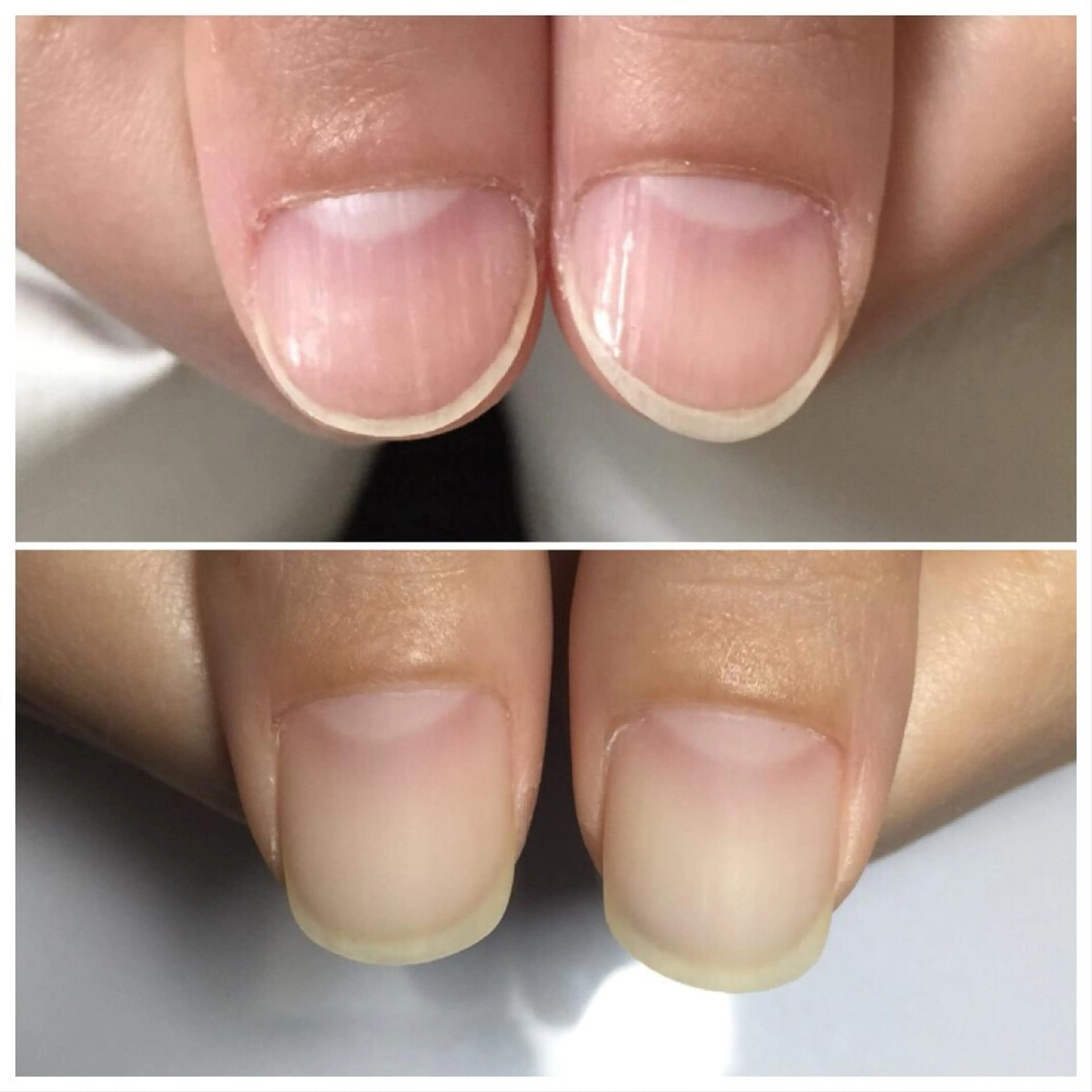 ネイル はたちや あみのマツエク・マツパデザイン