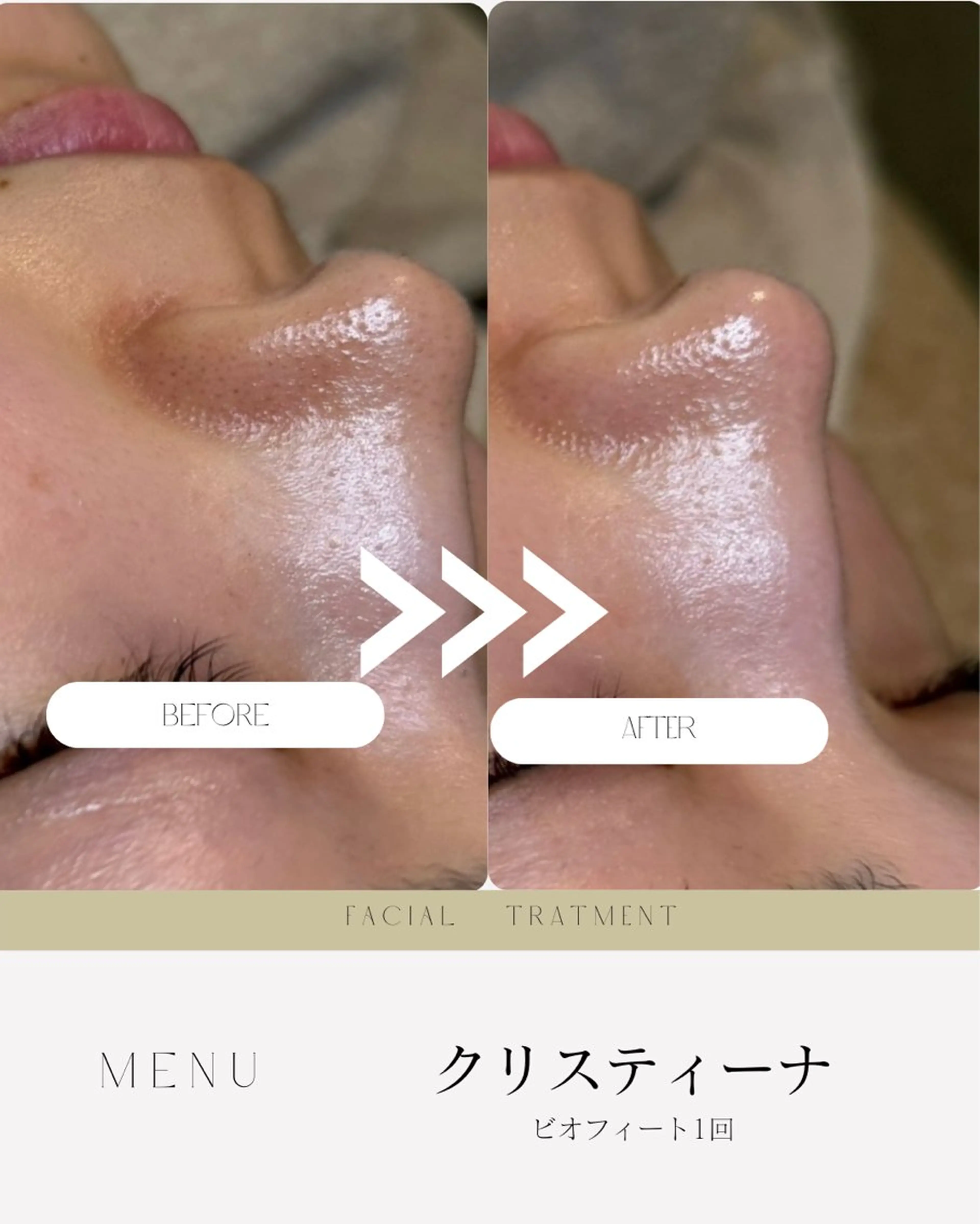 atelier design 【アトリエデザイン】所属・肌質・体質改善✖️ 小顔｜Rikaのエステ・リラクイメージ