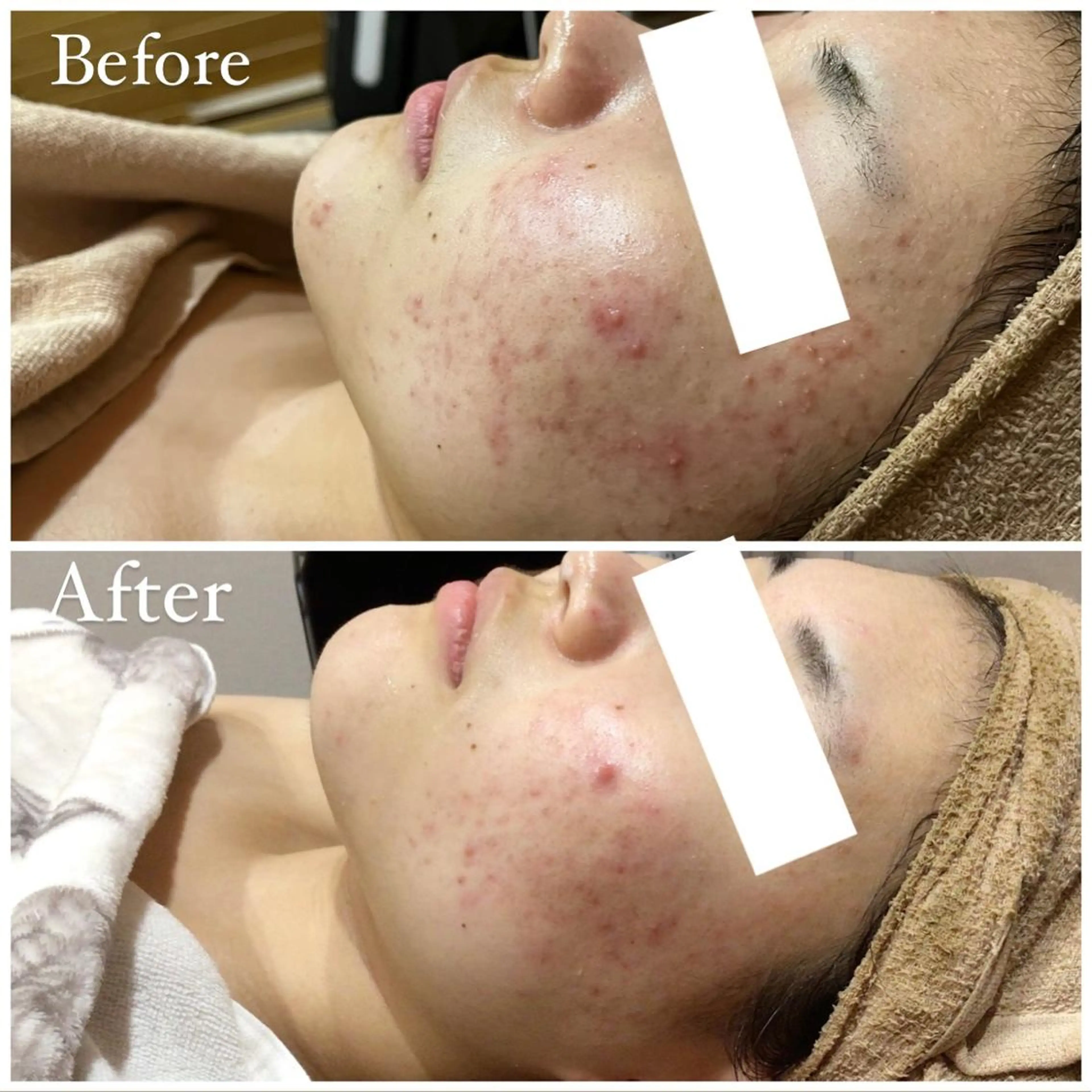 ハーブピーリング専門 muro.のエステ・リラクイメージ