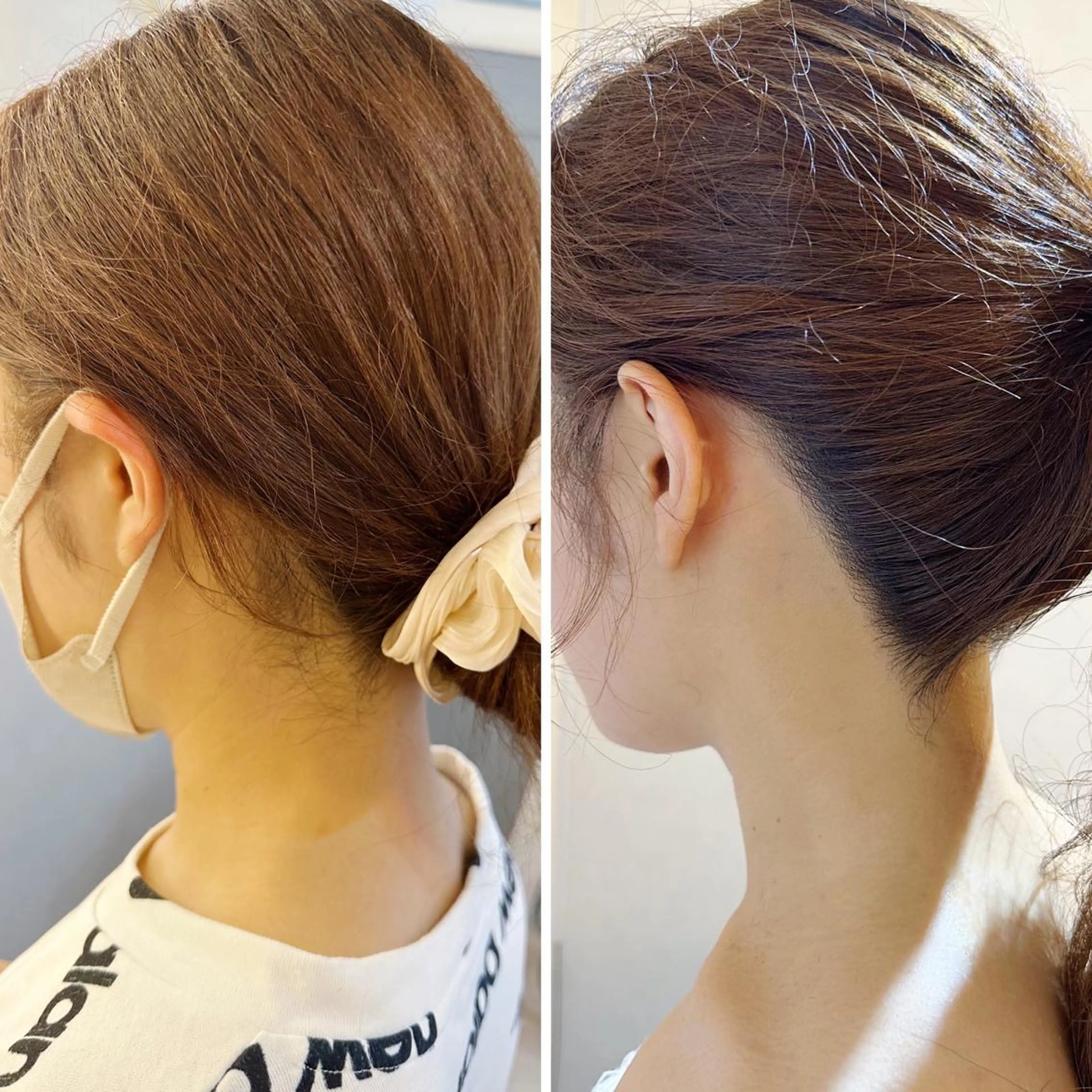 脱毛 うなじ脱毛/美肌脱毛 LABELのエステ・リラクイメージ