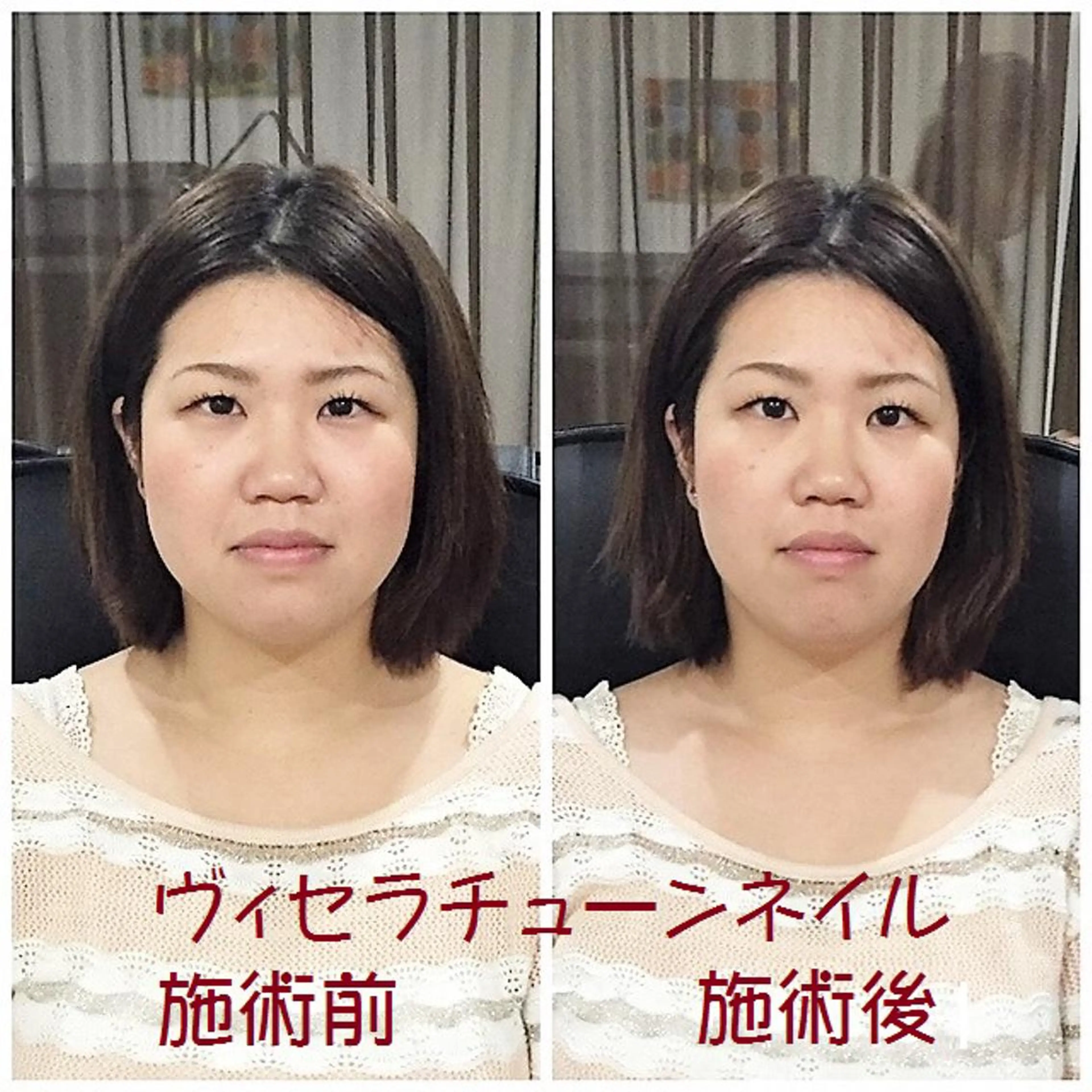 ネイル マナビス& ボワールのネイルデザイン