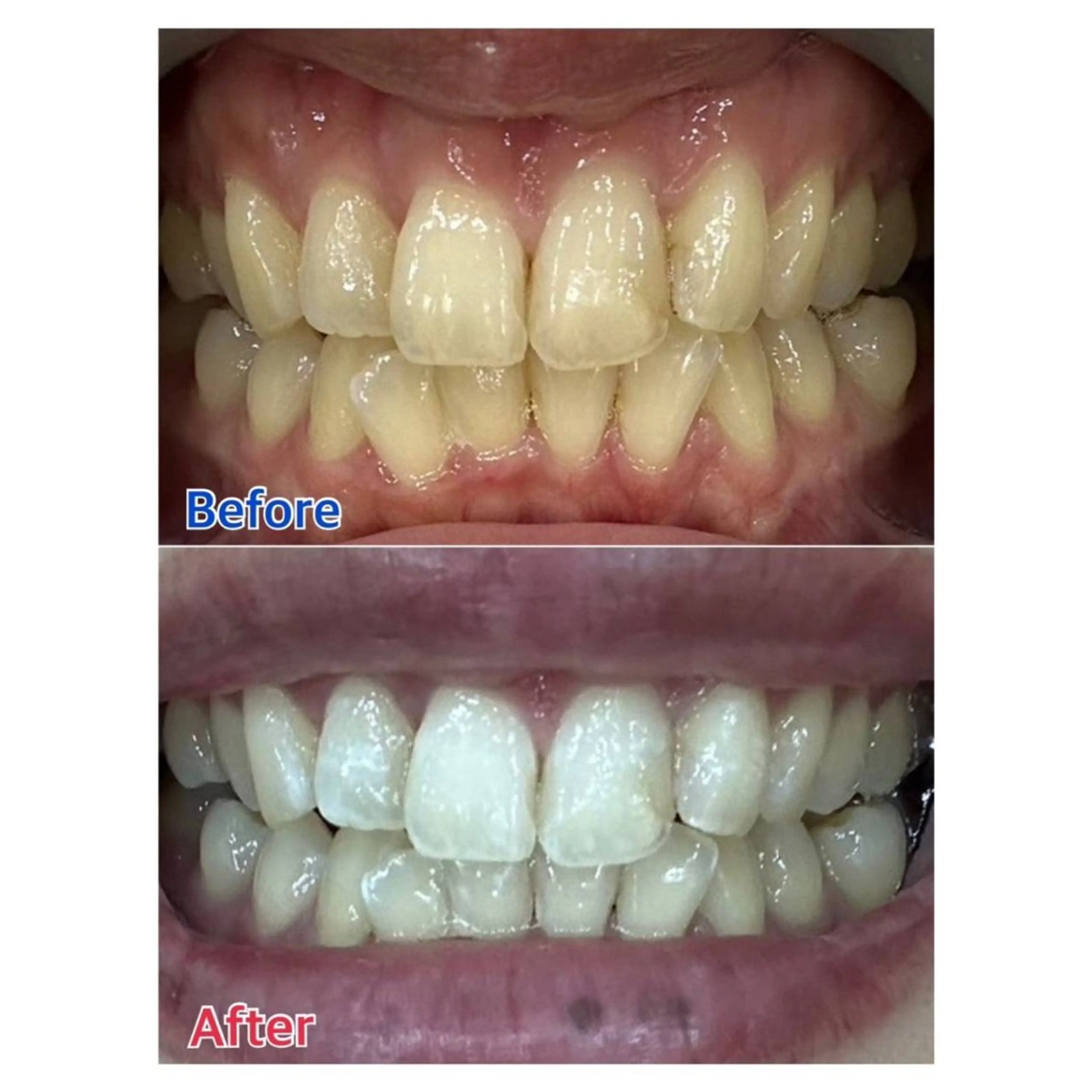 MBEAUTYSALON 千葉店・京成大久保所属・Melty 輝のその他イメージ