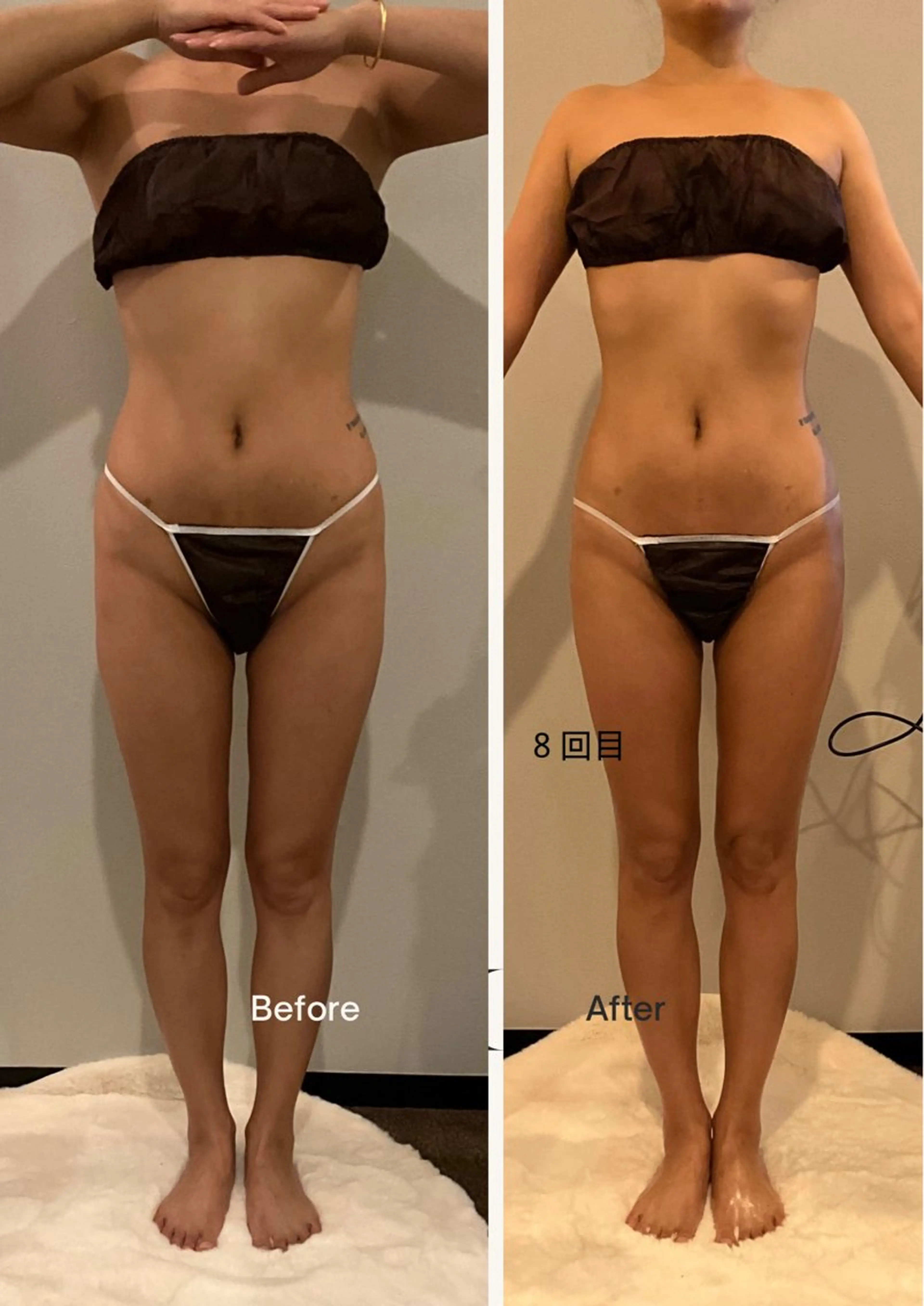 エステ リラク ✨痩身 ✨ハイパーナイフEXのエステ・リラクイメージ