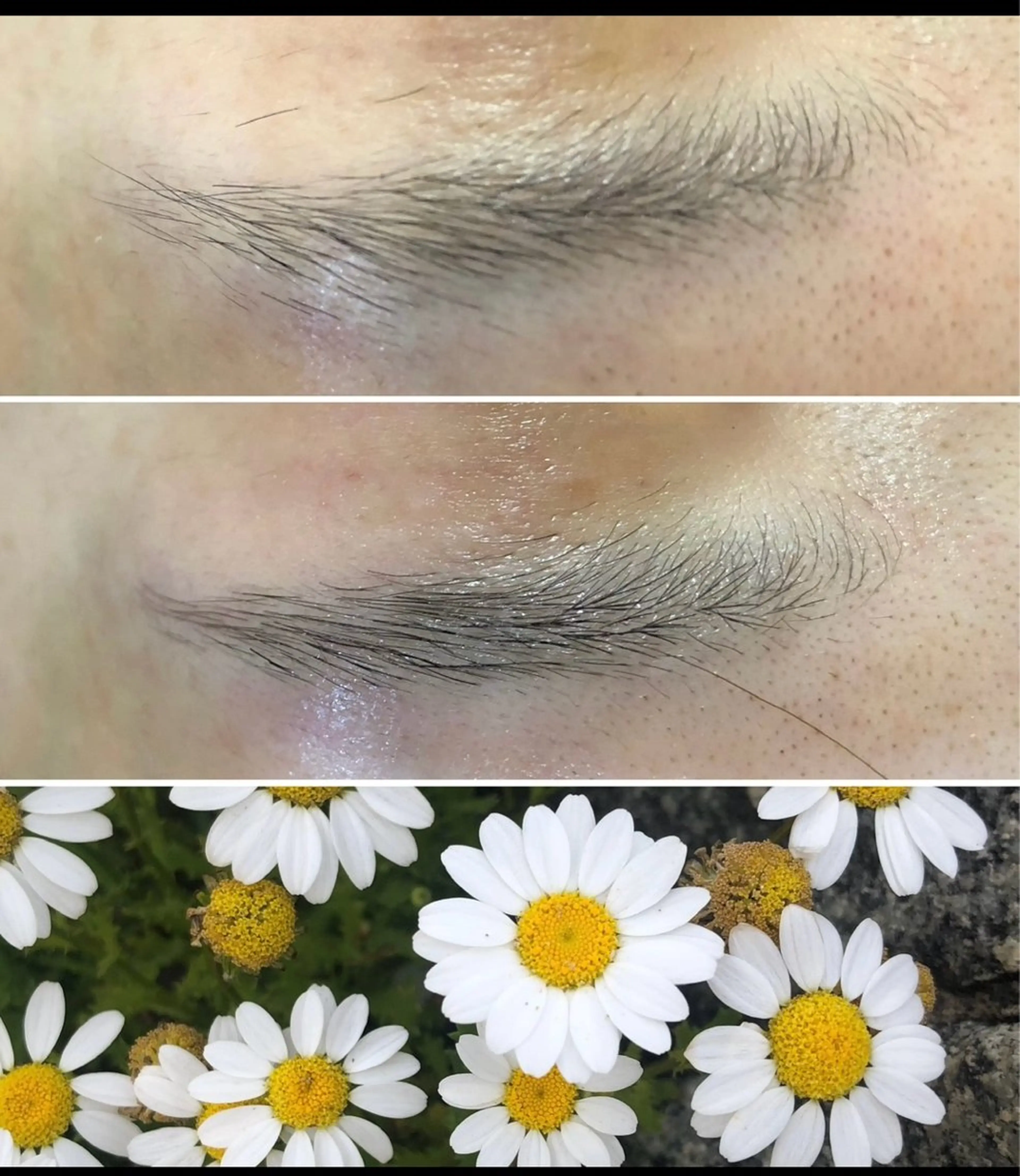 脱毛 HIRAMORI E.T.S所属・HIRAMORI E.T.Sのエステ・リラクイメージ