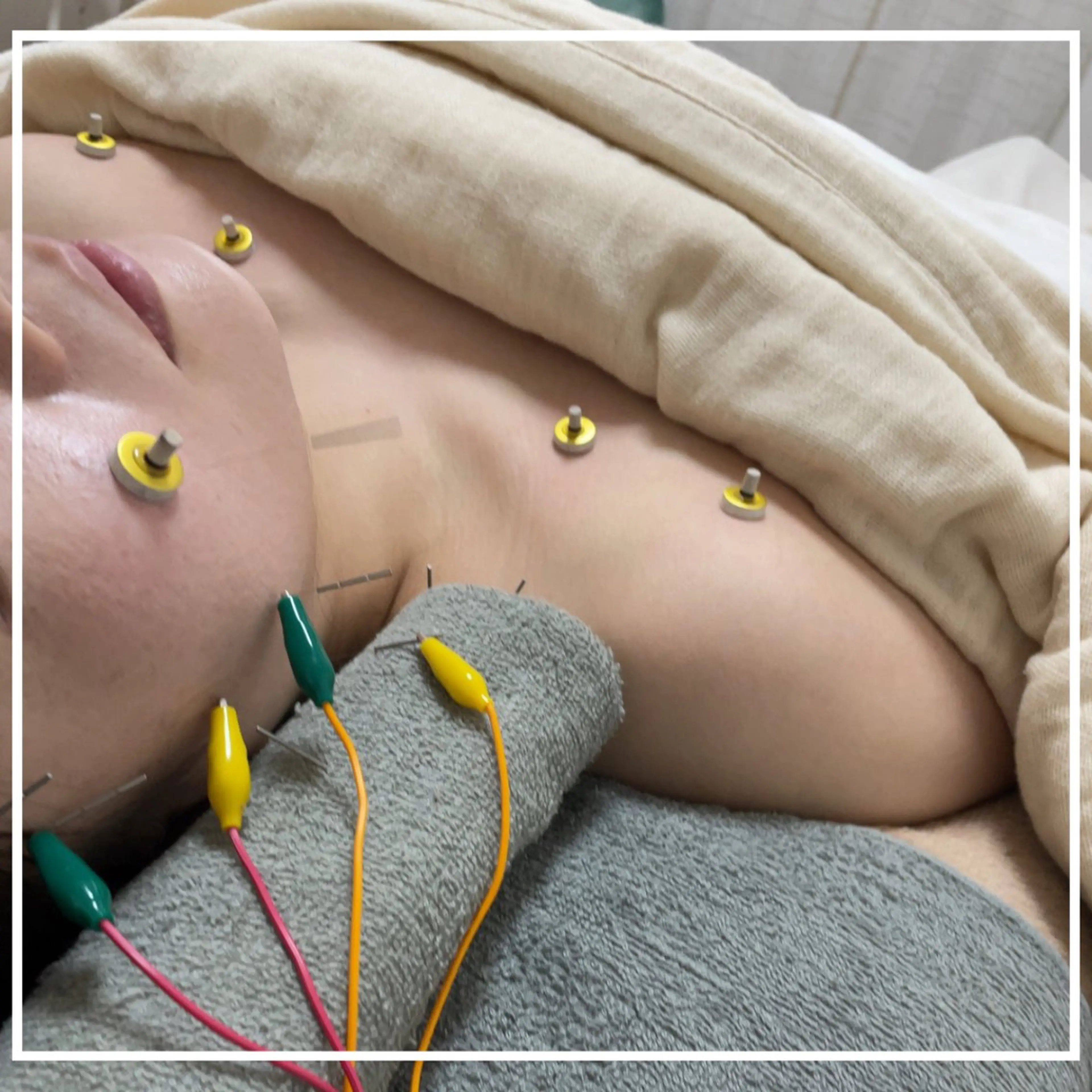 美容鍼灸サロン   colorier所属・美容鍼灸サロン colorierのエステ・リラクイメージ