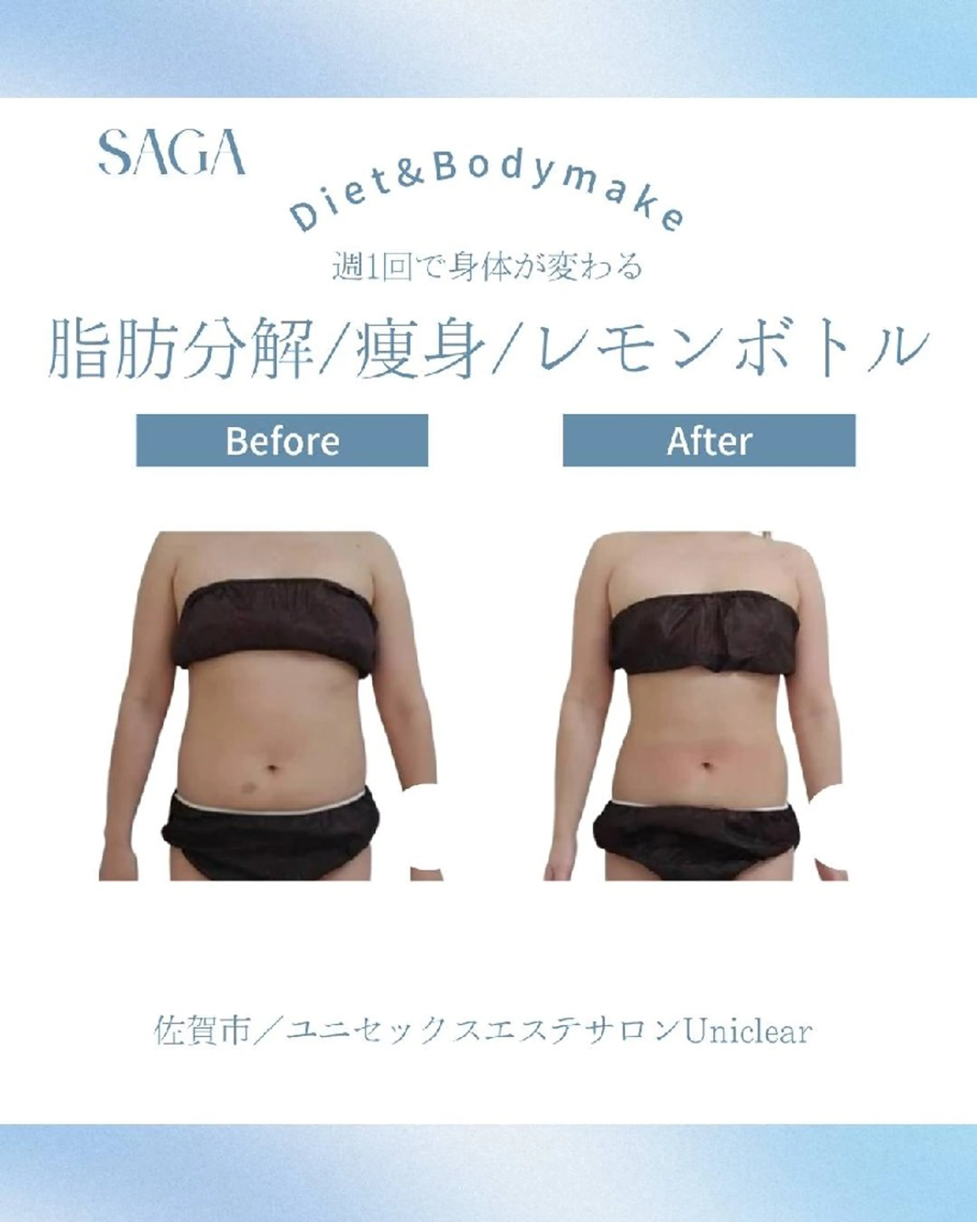 お腹集中★レ モンボトル★キャビテーション付きの写真