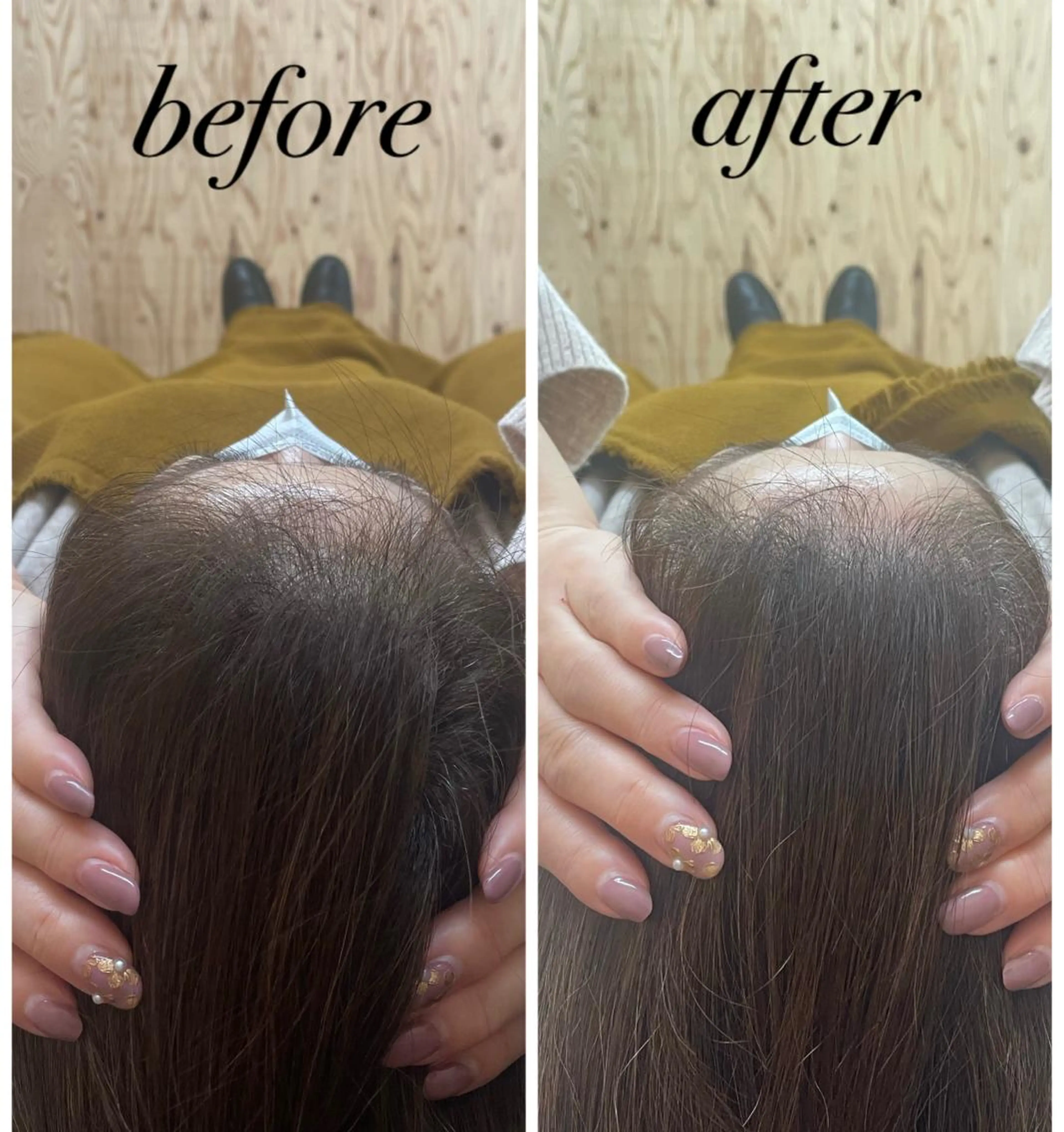 リラク ate'所属・個室ドライヘッドスパ 🍃moriのエステ・リラクイメージ