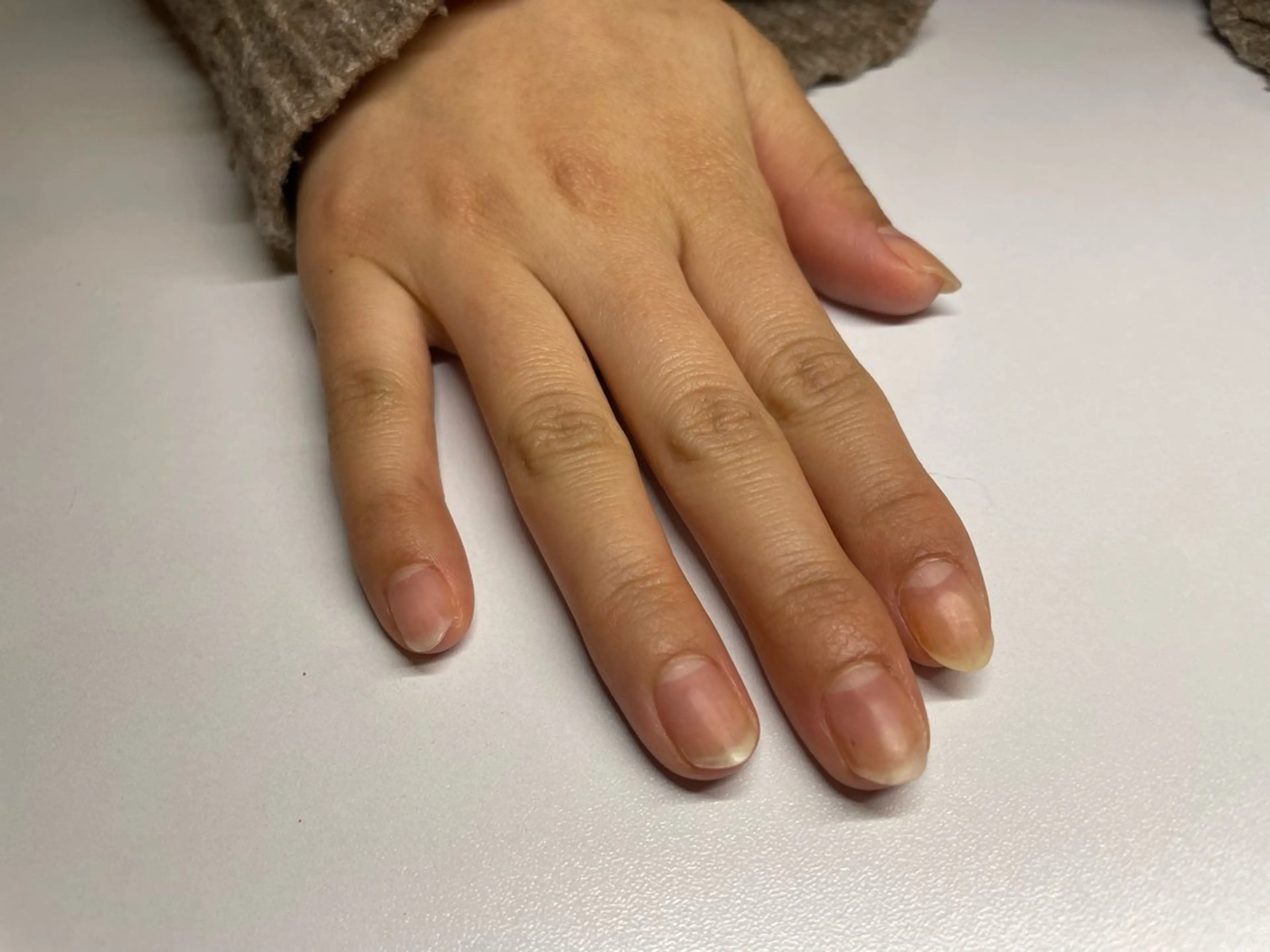 ソフトジェルオフの写真