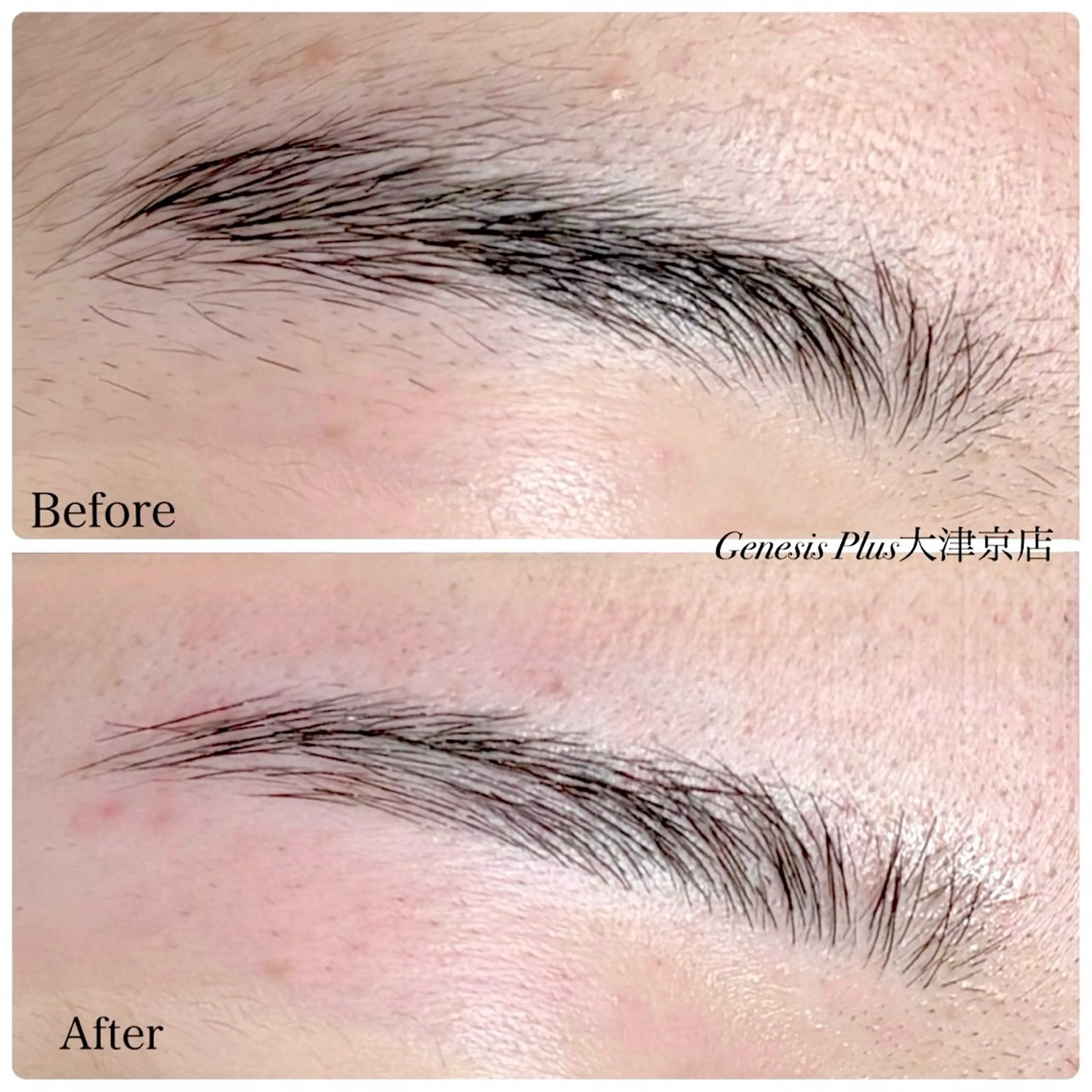 アイブロウ Genesis Plus大津京店のエステ・リラクイメージ