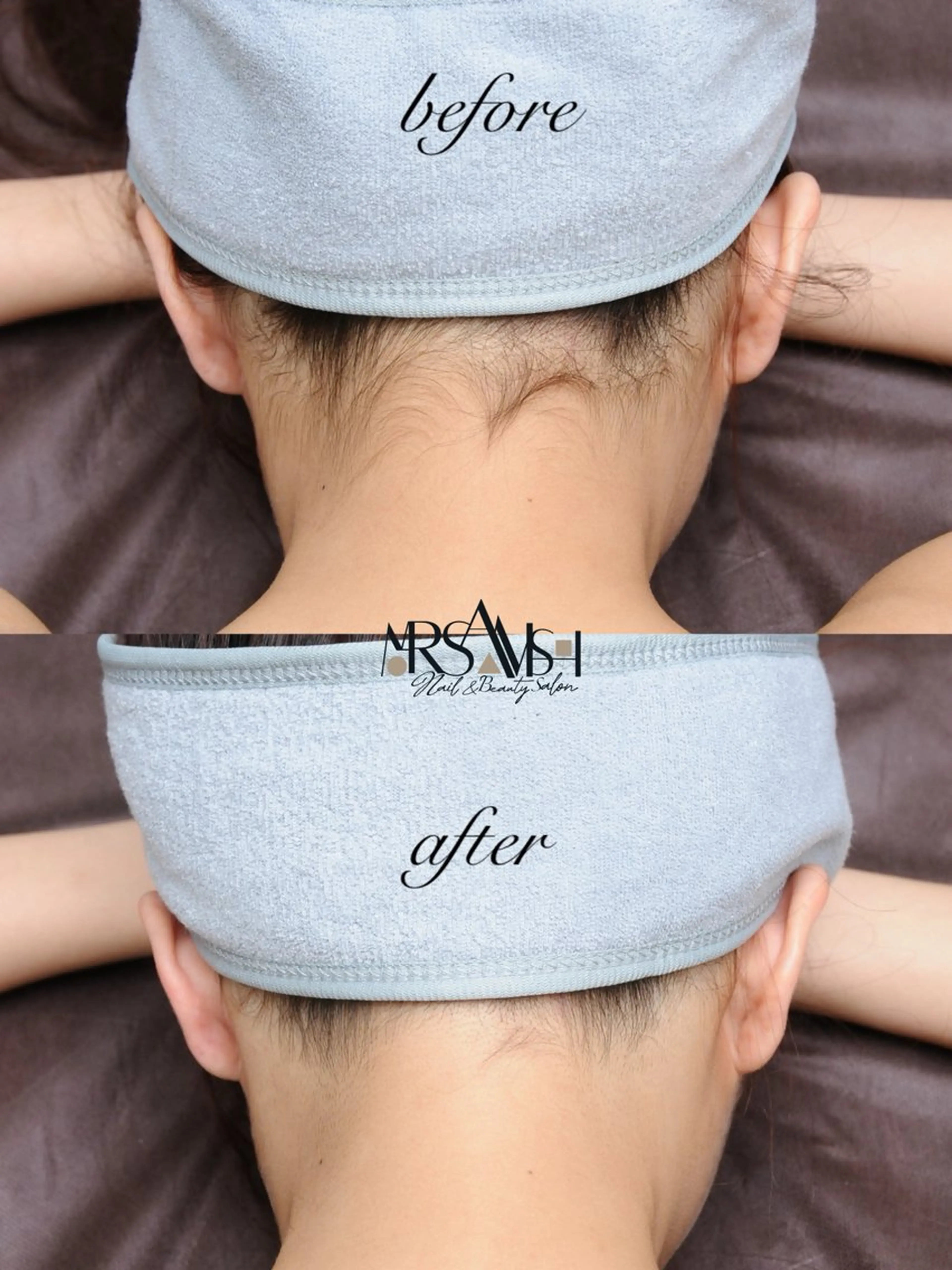 ◯△□所属・最新美肌脱毛 韓国水光肌🫧のその他イメージ