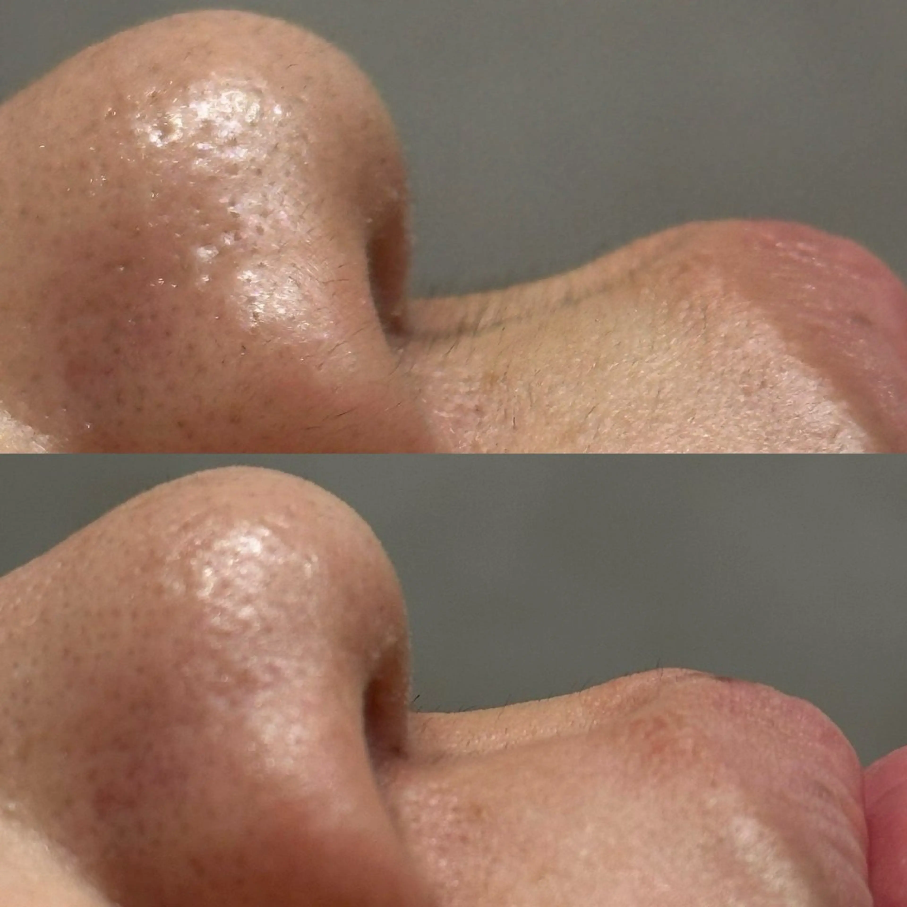 エステ ハーブ&艶肌ワックス re:proのエステ・リラクイメージ