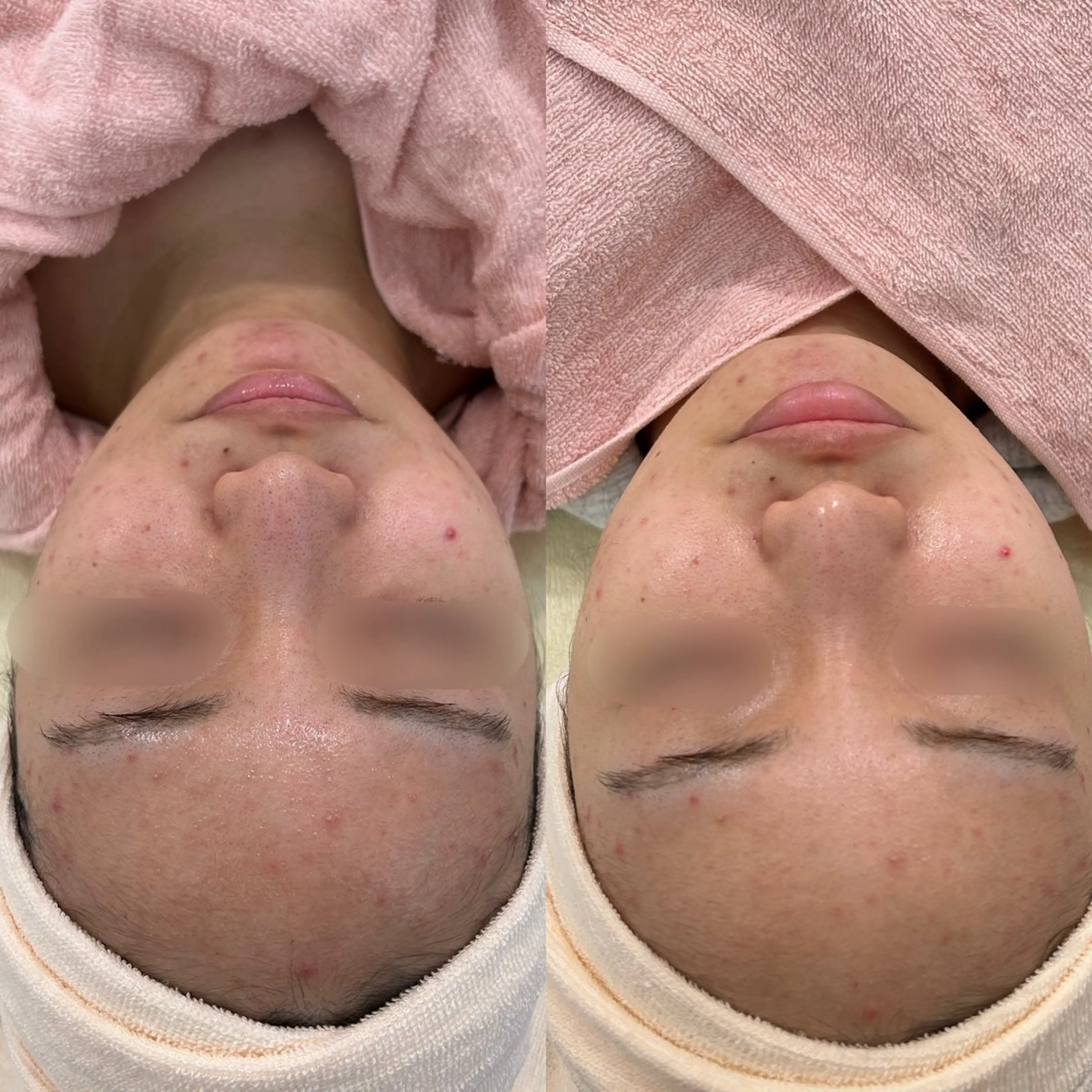 〈etre〉トータルビューティーサロン所属・etre - 韓国肌管理 -のエステ・リラクイメージ