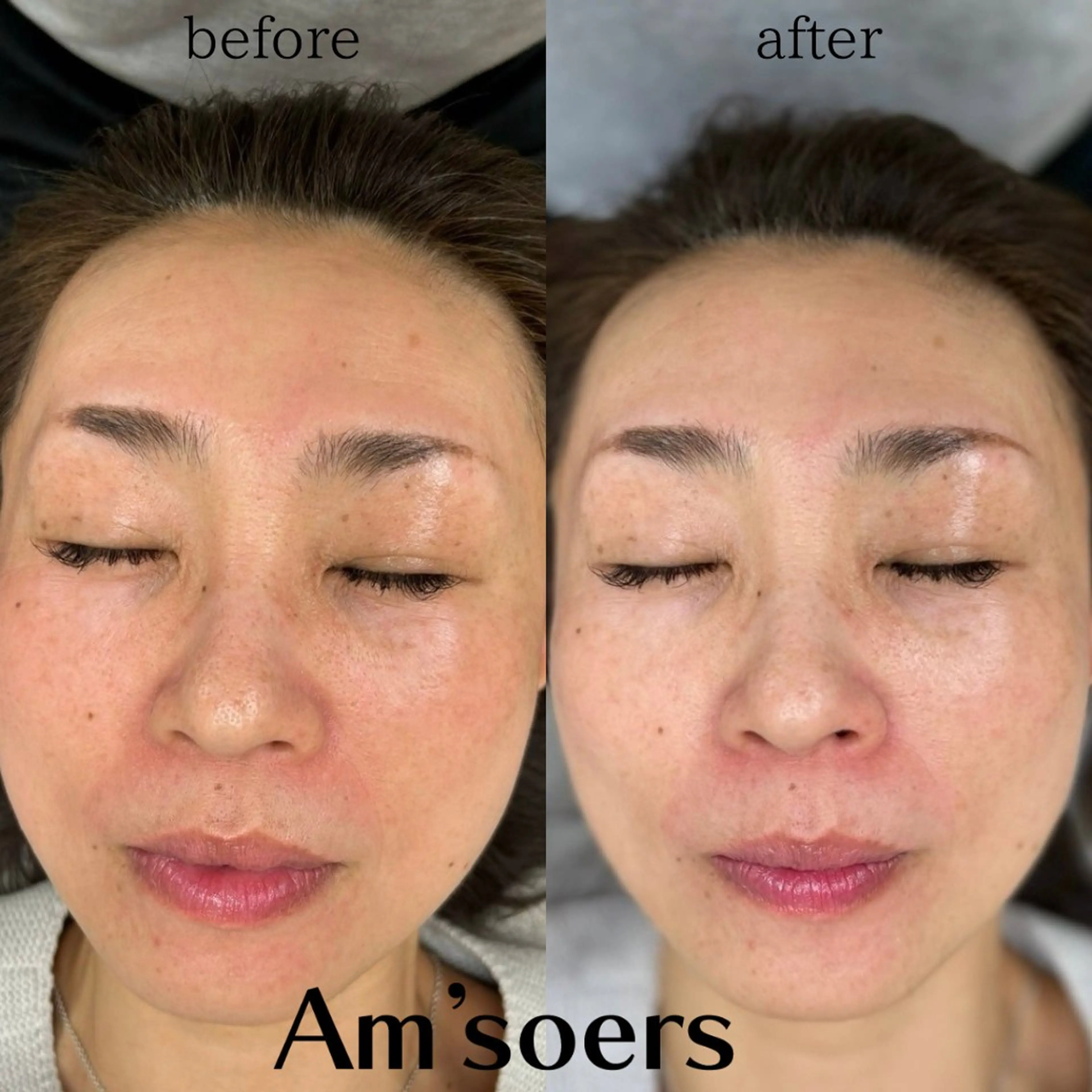 エステ Am'soers 本橋のエステ・リラクイメージ