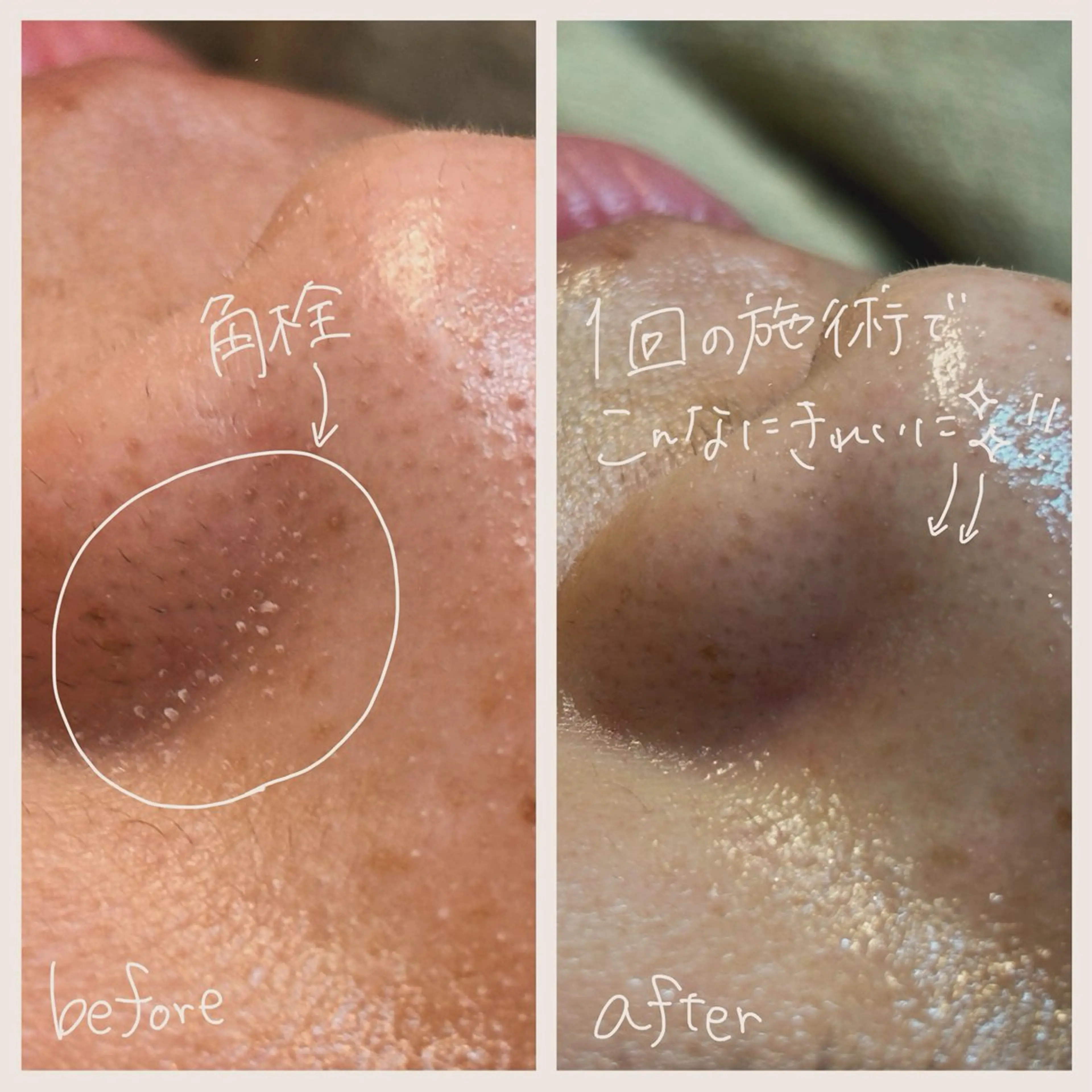 エステ sourire.11 ‪☺︎‬‪emiのエステ・リラクイメージ