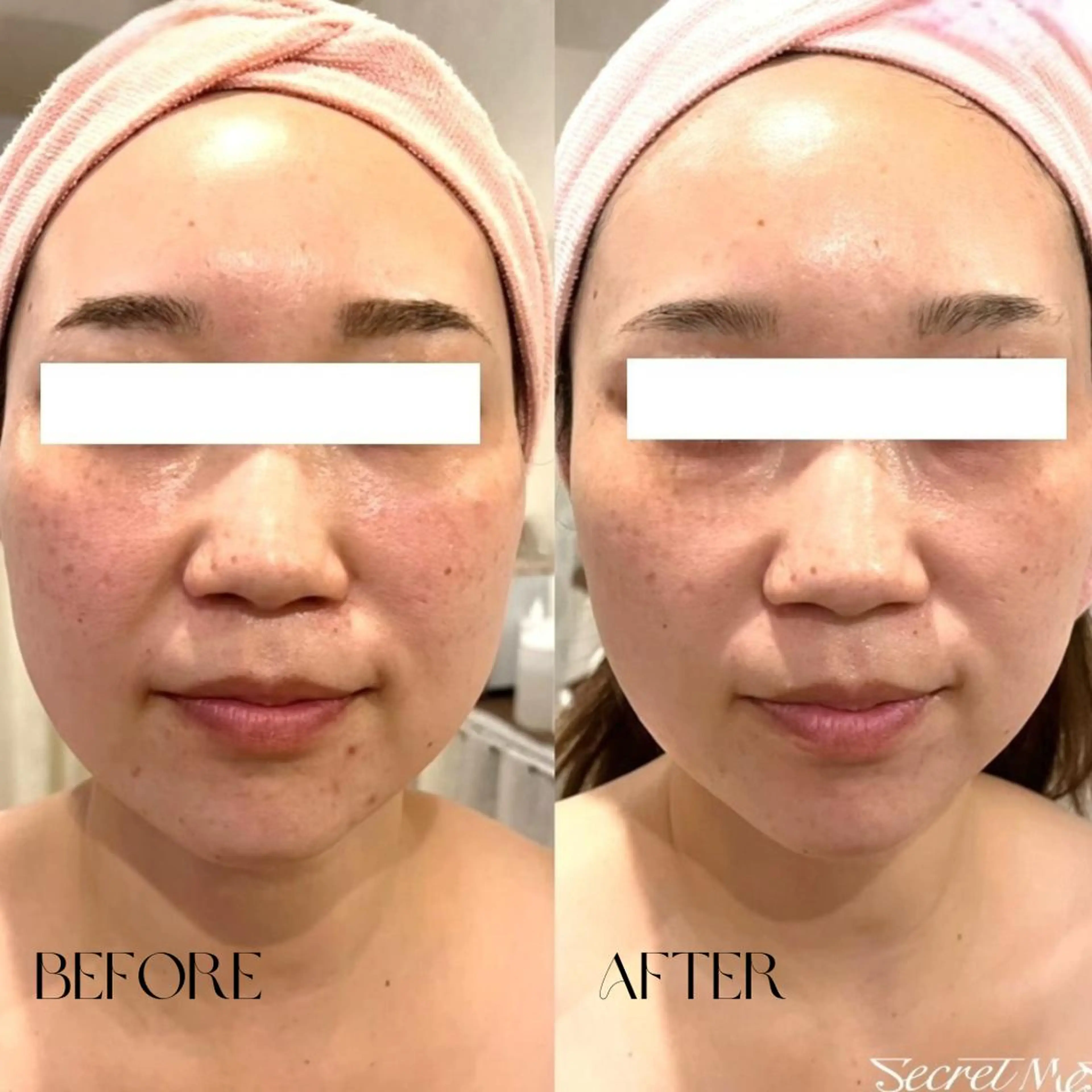 エステ リラク B-st. 下北沢のエステ・リラクイメージ