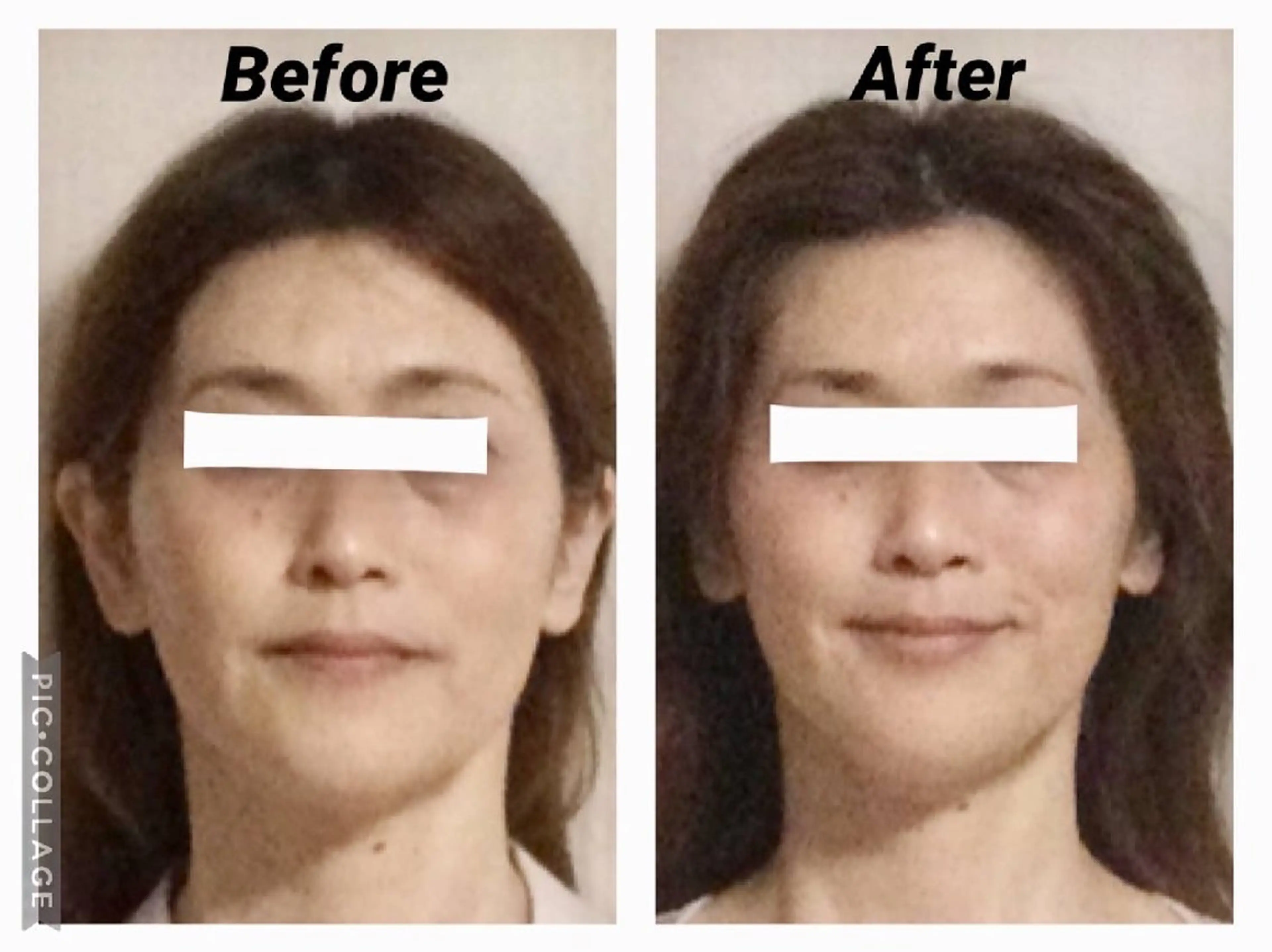 小顔矯正Sho  FaceDesignのエステ・リラクイメージ